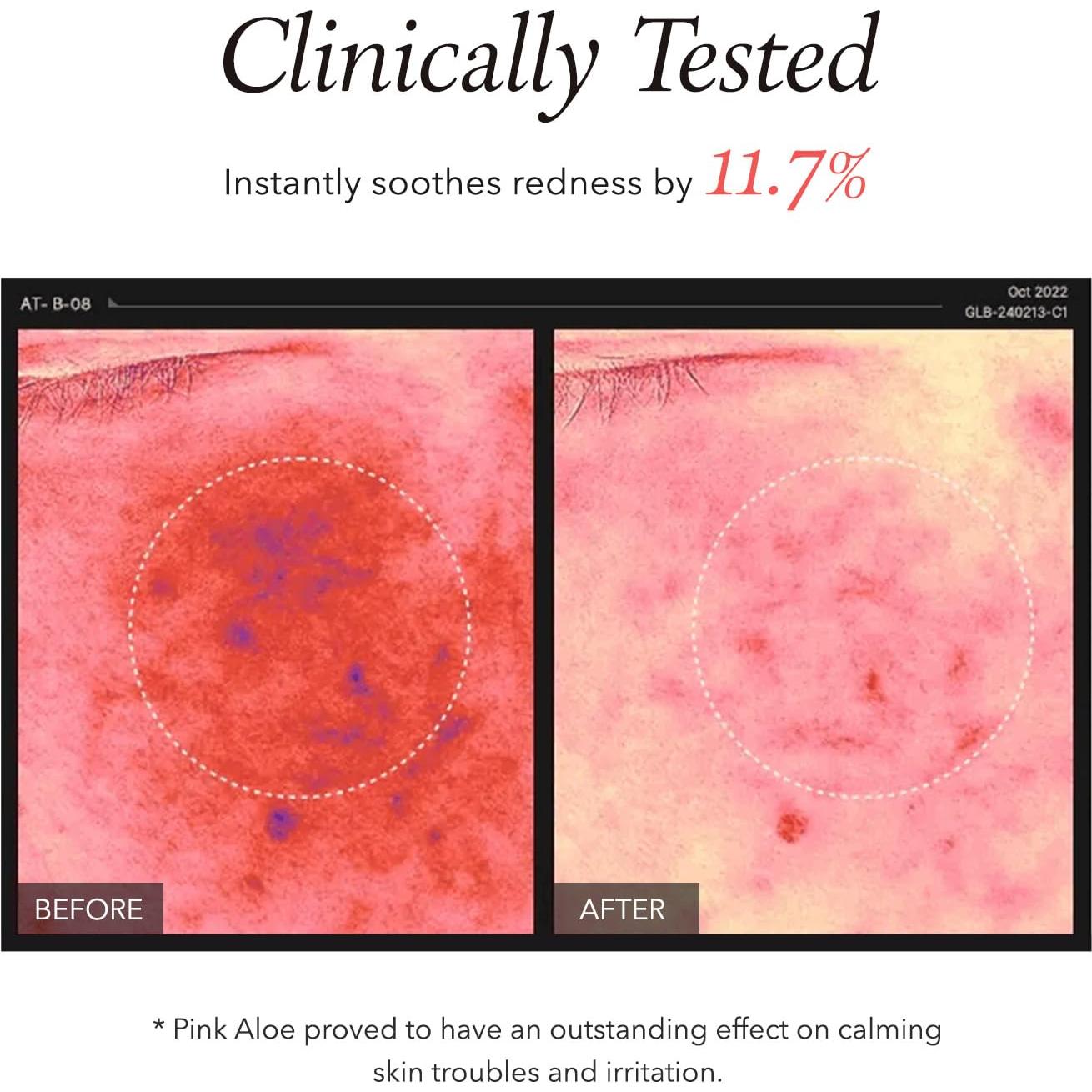 Limpiador Facial Aprilskin Aloe Rosa 189g Exfoliante Suave