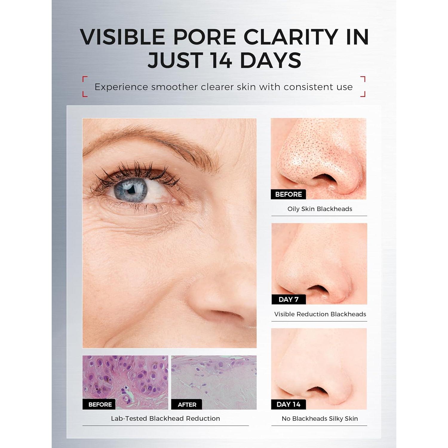 Mascarilla de Arcilla NING DERMOLOGIE 110g Piel Sensible Hidratante