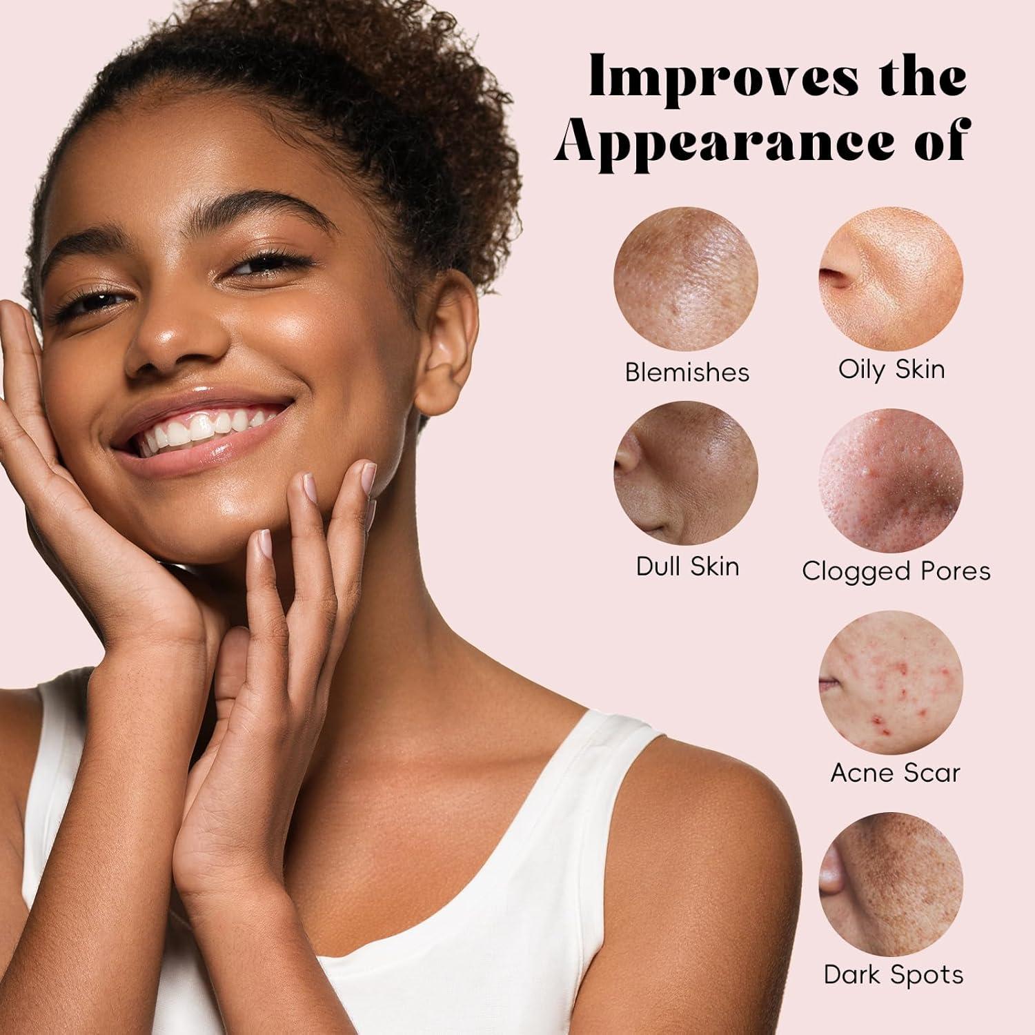 Juego de Mascarillas Faciales ANRCOLLECT - 4 Piezas con Arcilla