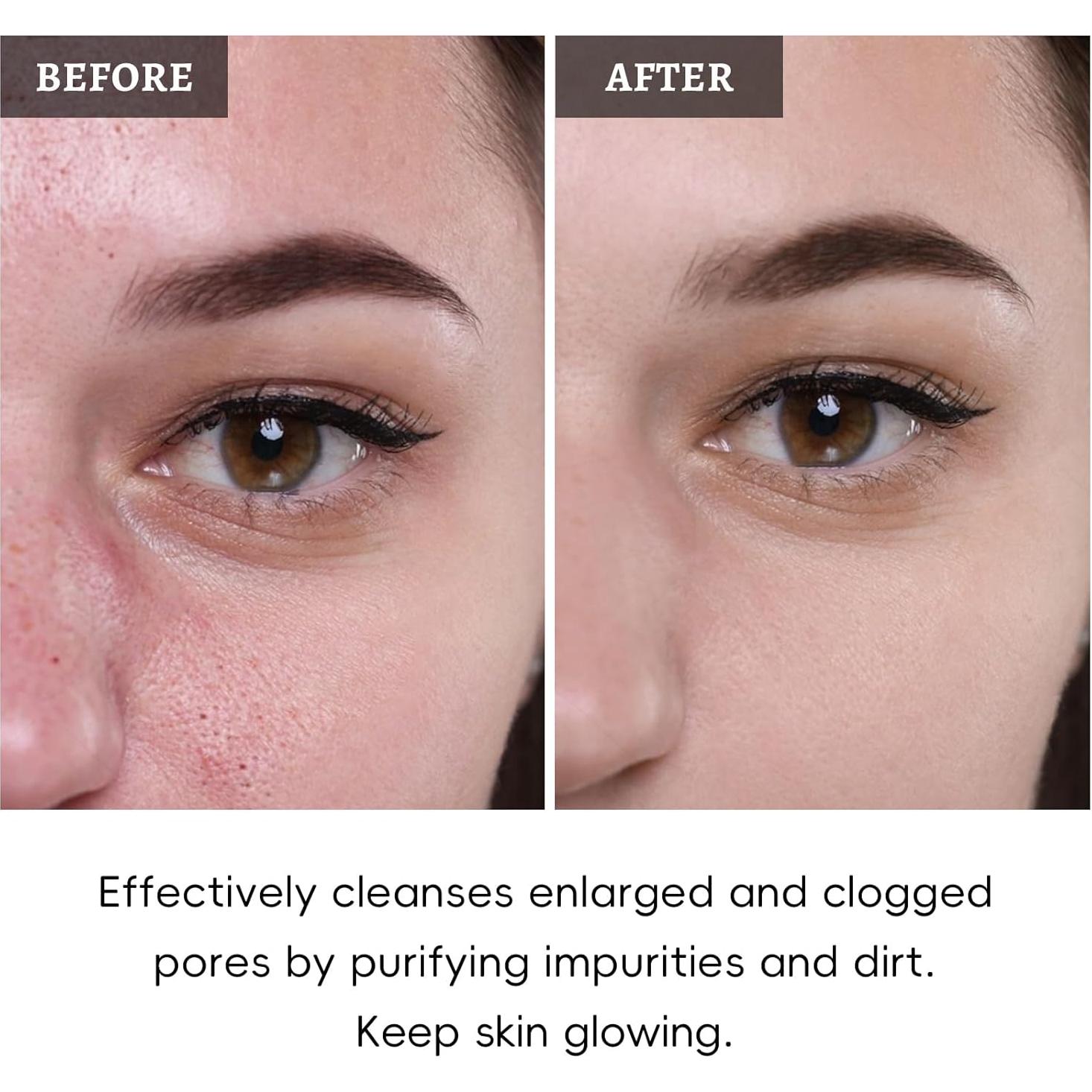 Juego de Mascarillas Faciales ANRCOLLECT - 4 Piezas con Arcilla