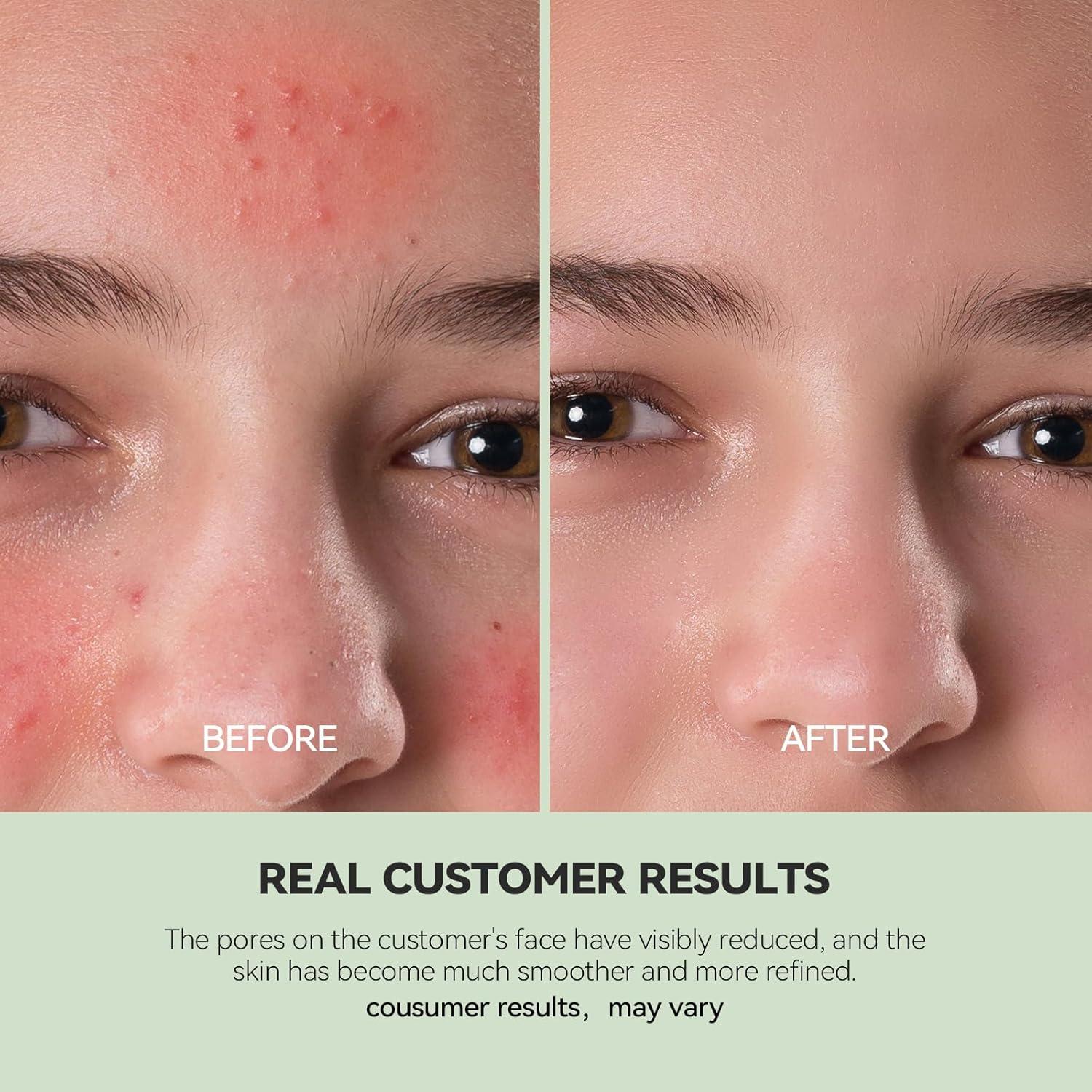 Mascarilla de Arcilla Limpiadora WNP con Niacinamida 100g