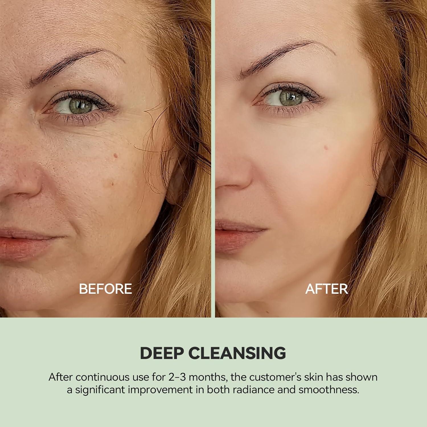 Mascarilla de Arcilla Limpiadora WNP con Niacinamida 100g