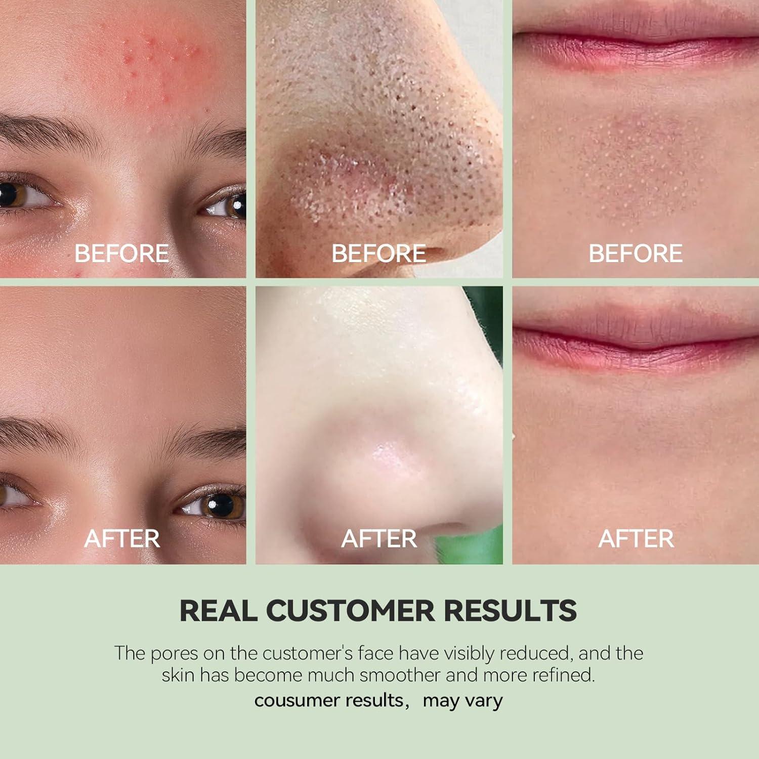 Mascarilla de Arcilla Limpiadora WNP con Niacinamida 100g