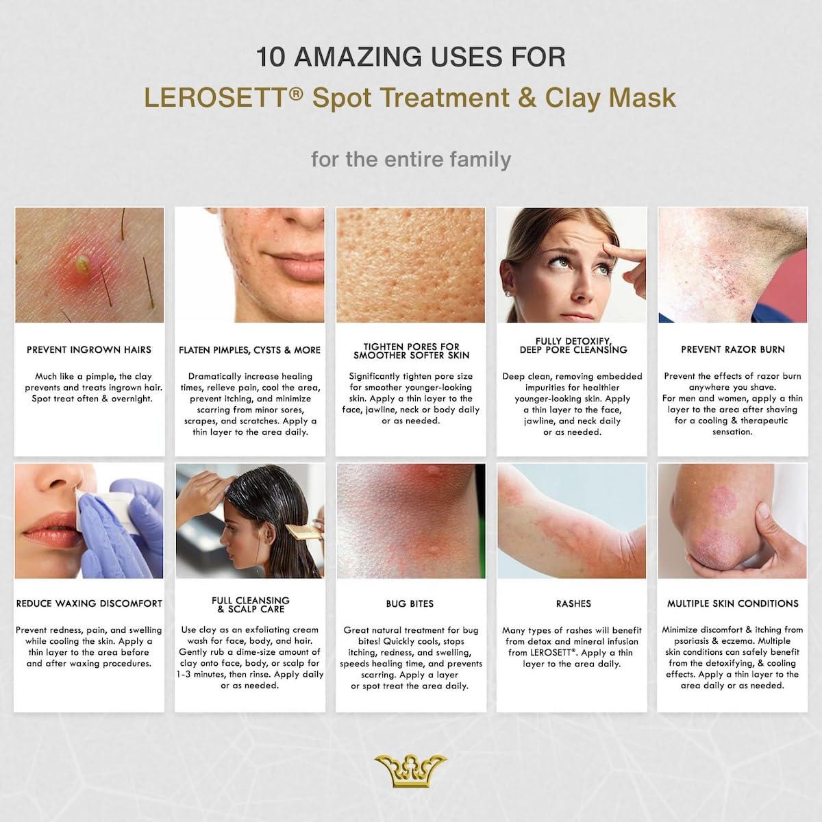 Mascarilla Facial de Arcilla LEROSETT 85g - Tratamiento Acné