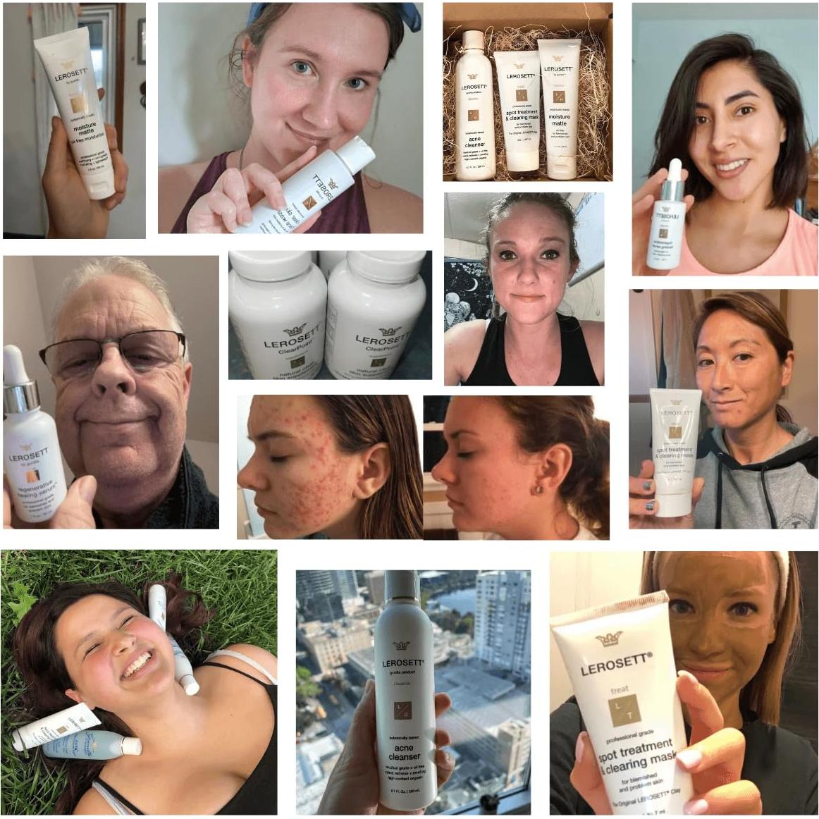 Mascarilla Facial de Arcilla LEROSETT 85g - Tratamiento Acné