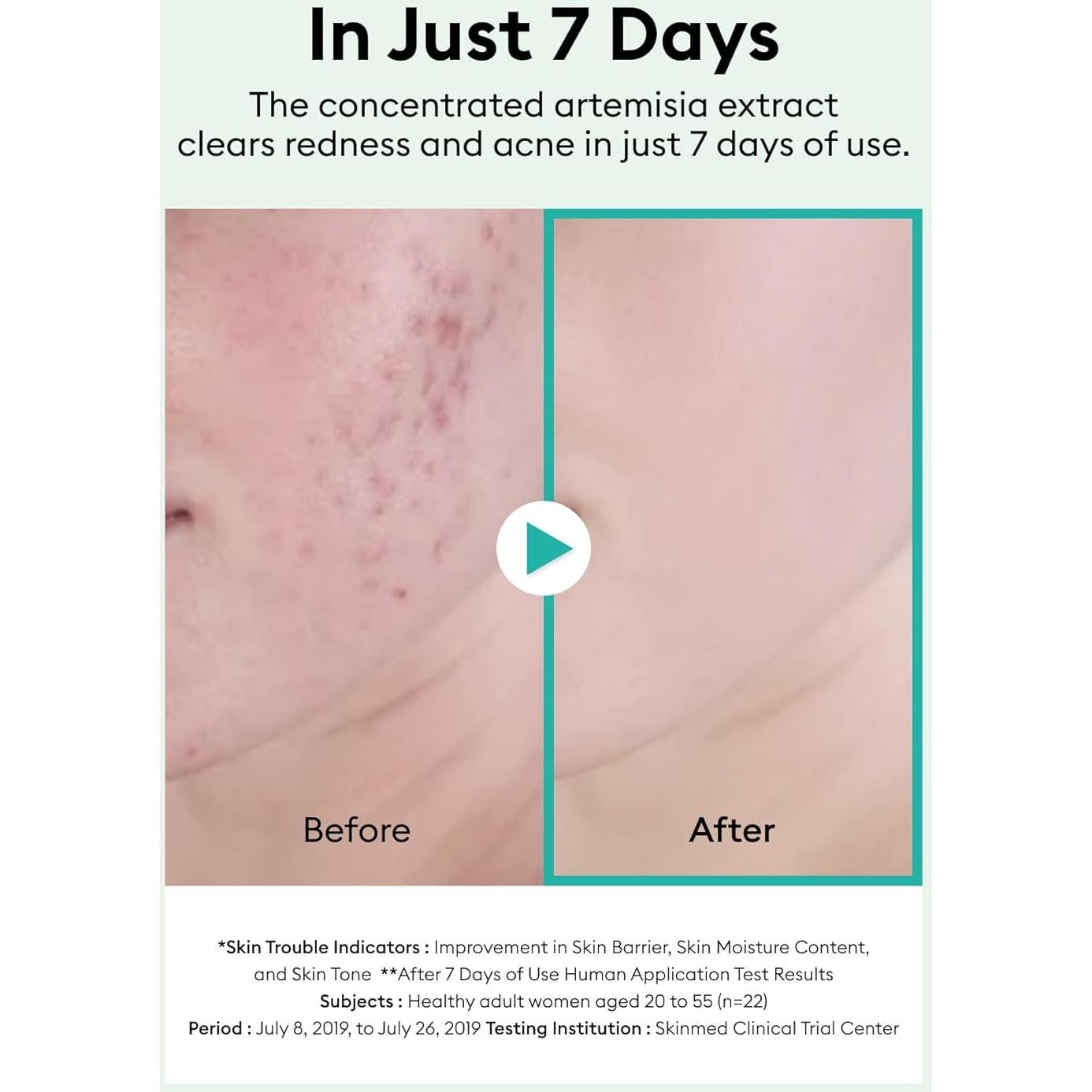 Suero Facial Calmante MISSHA Artemisia 50ml - Piel Sensible