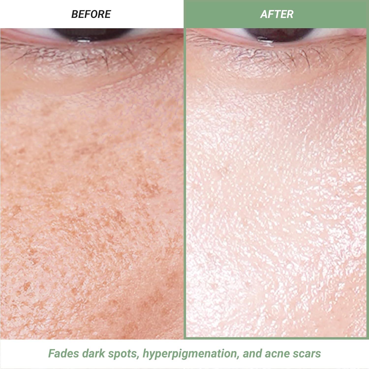 Suero de Vitamina C Meebak 31g | Aclarador Antienvejecimiento