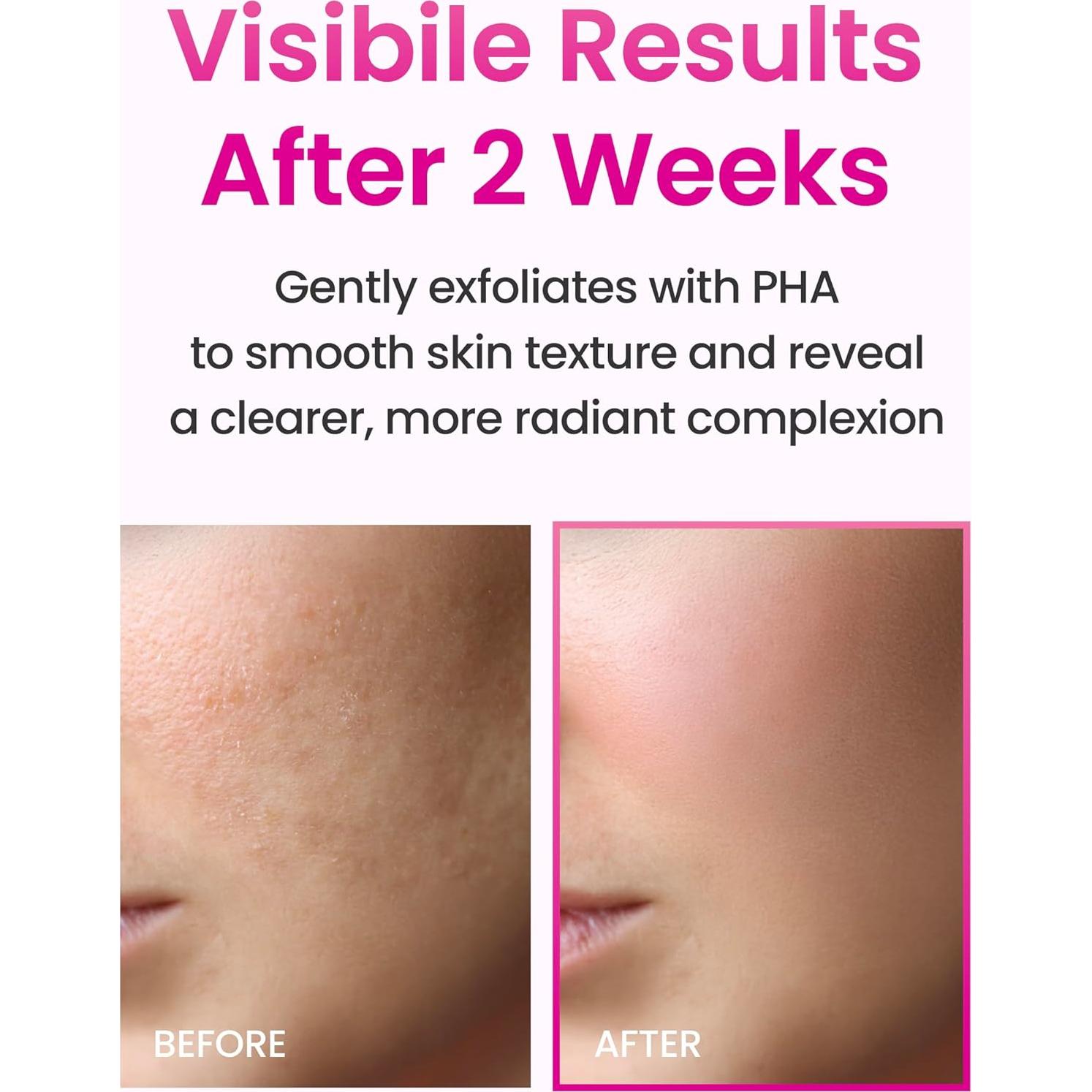 YADAH Colágeno Hydra Essence 150ml - Hidratación Profunda