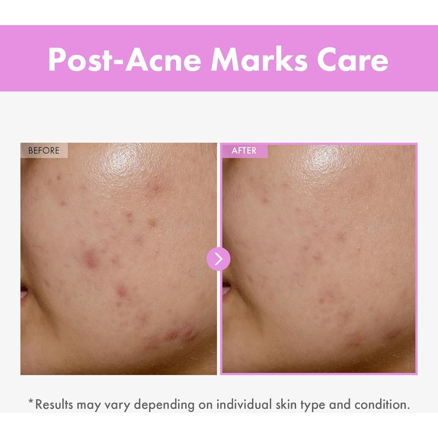 Suero Facial Tosowoong 9 Péptidos 150ml - Cuidado Piel Coreano