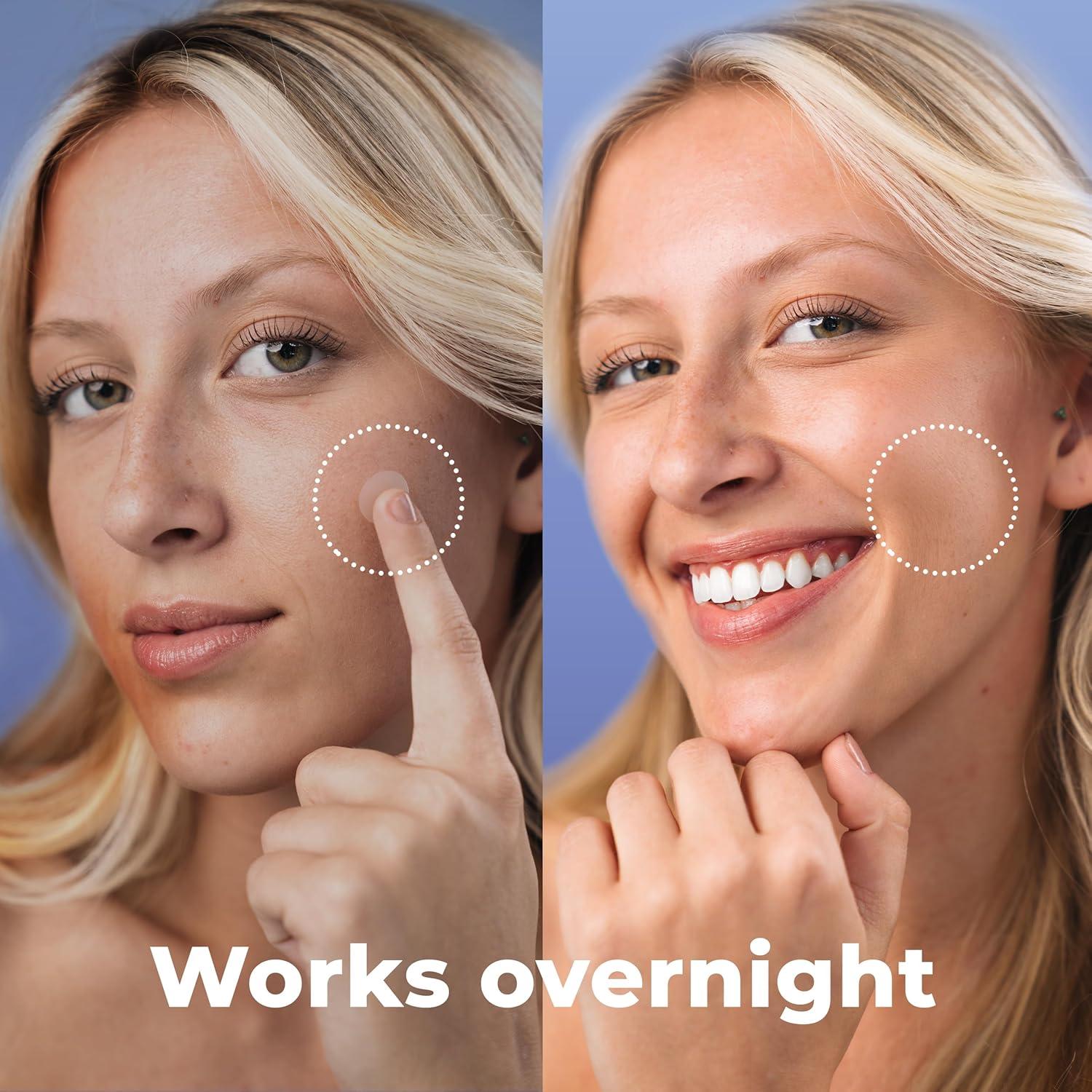 Parche para Granos Hydrocolloid PatchRx - 120 Unidades con Aceite de Árbol de Té