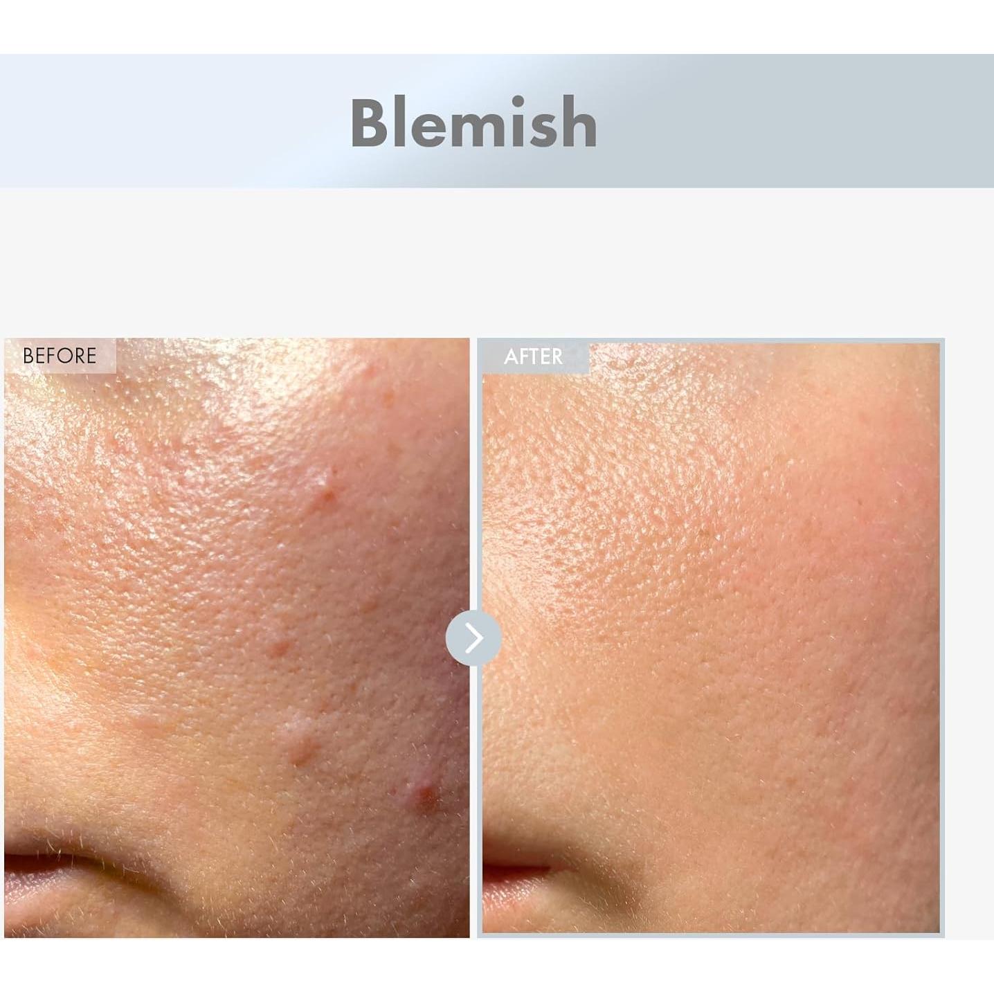 Suero Facial Niacinamida 15% MANTONG 30ml Piel Radiante