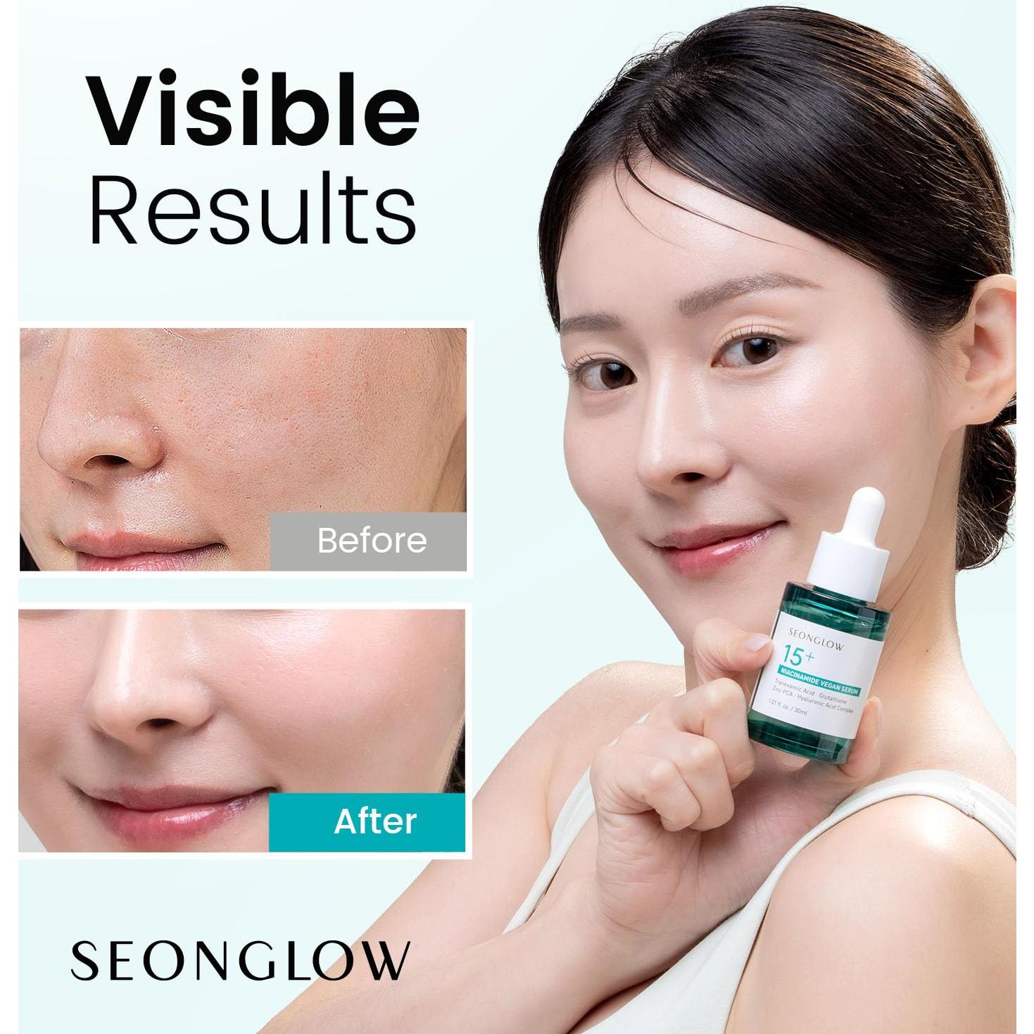 Suero Vegano de Niacinamida 15% SEONGLOW 30ml - Cuidado Piel