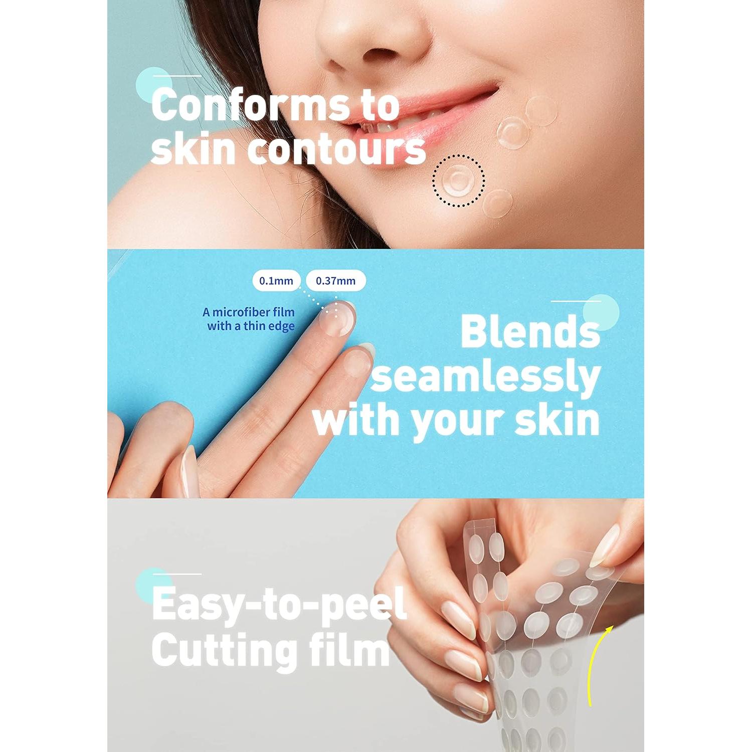 Parche para Acné Hidrocoloide OLIVE YOUNG 306 Unidades