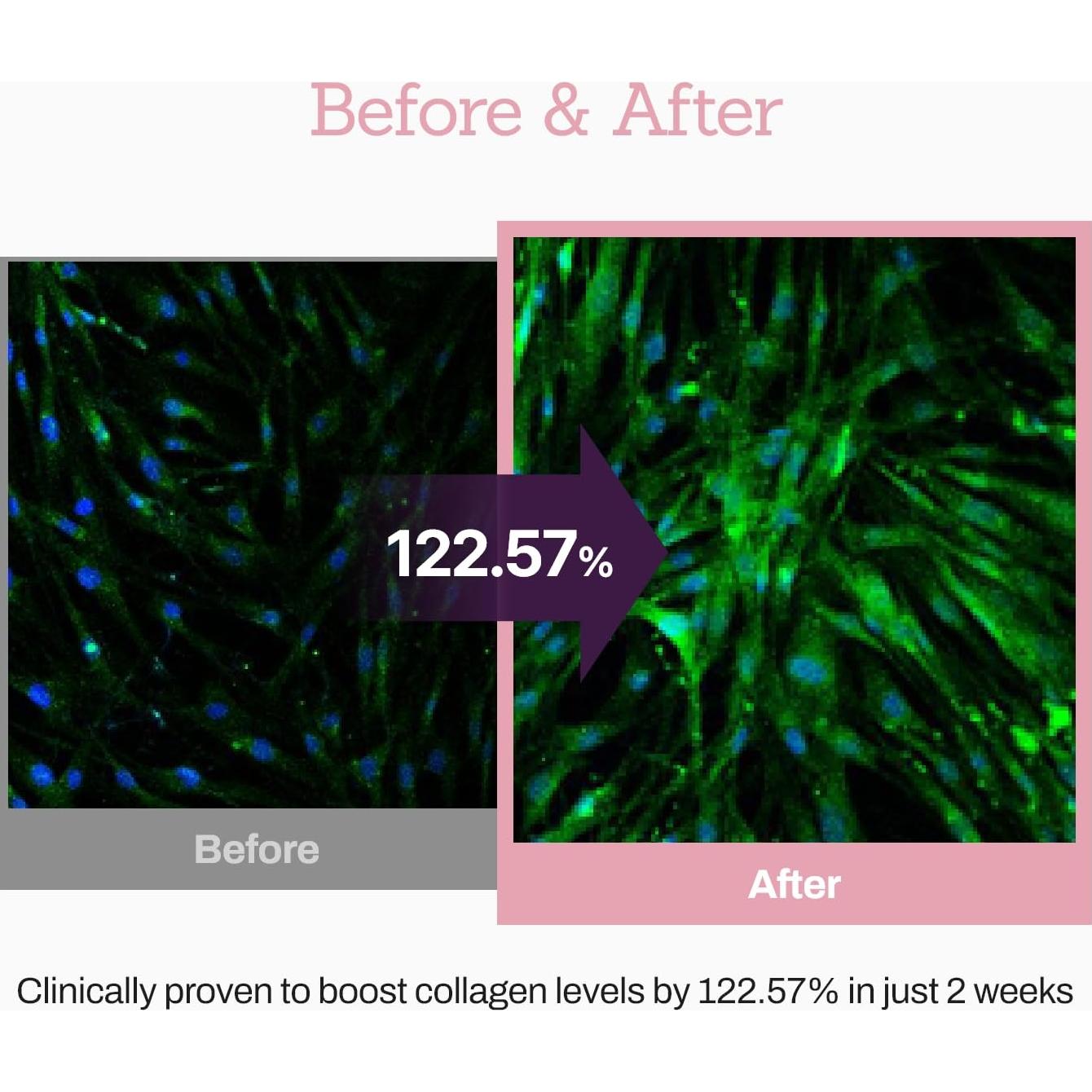 Suero de Colágeno Peptídico 30 ml - Cuidado de la Piel Coreano