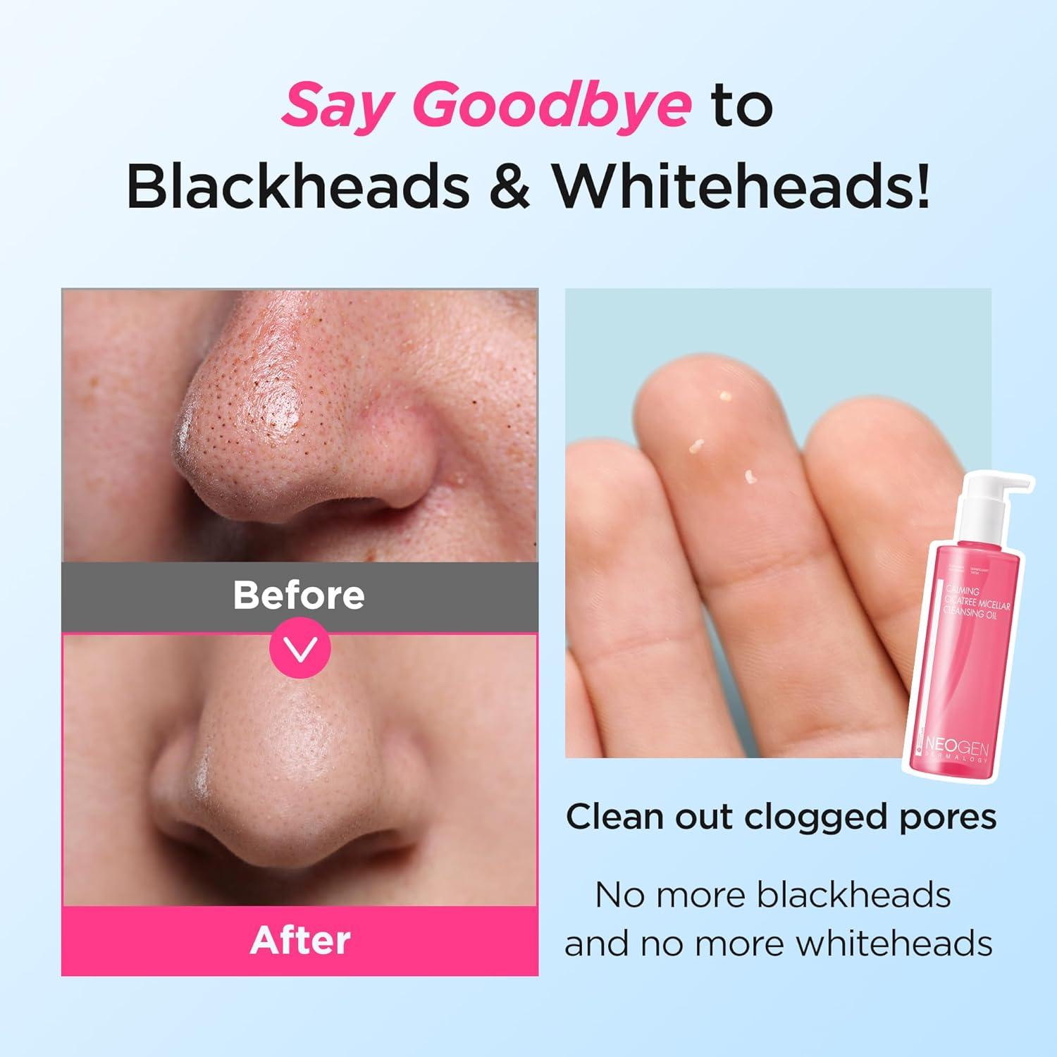 Aceite Limpiador Calmante Cica Tree Neogen 300ml K-Beauty