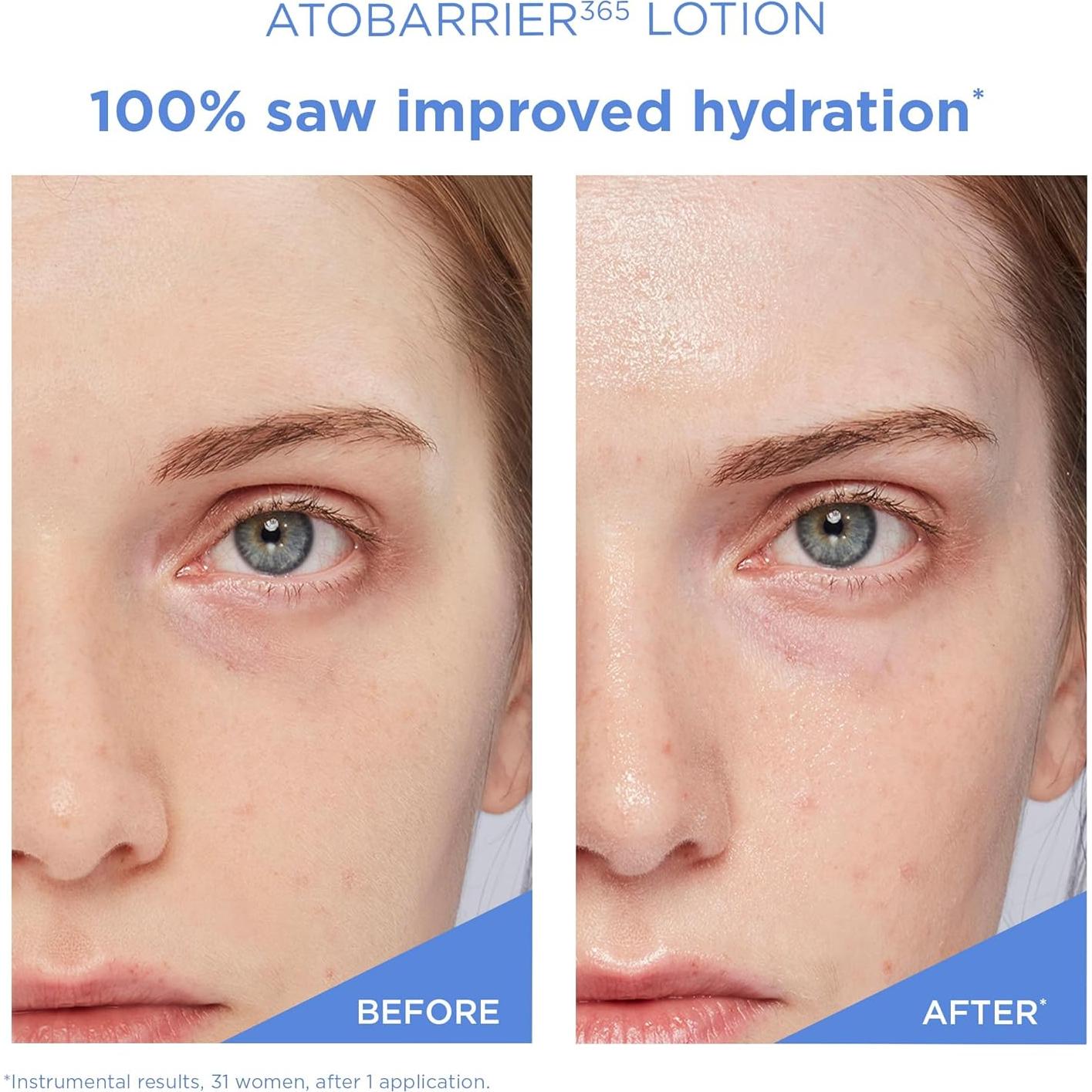 AESTURA Loción Hidratante Facial 90ml con Ceramidas Coreana