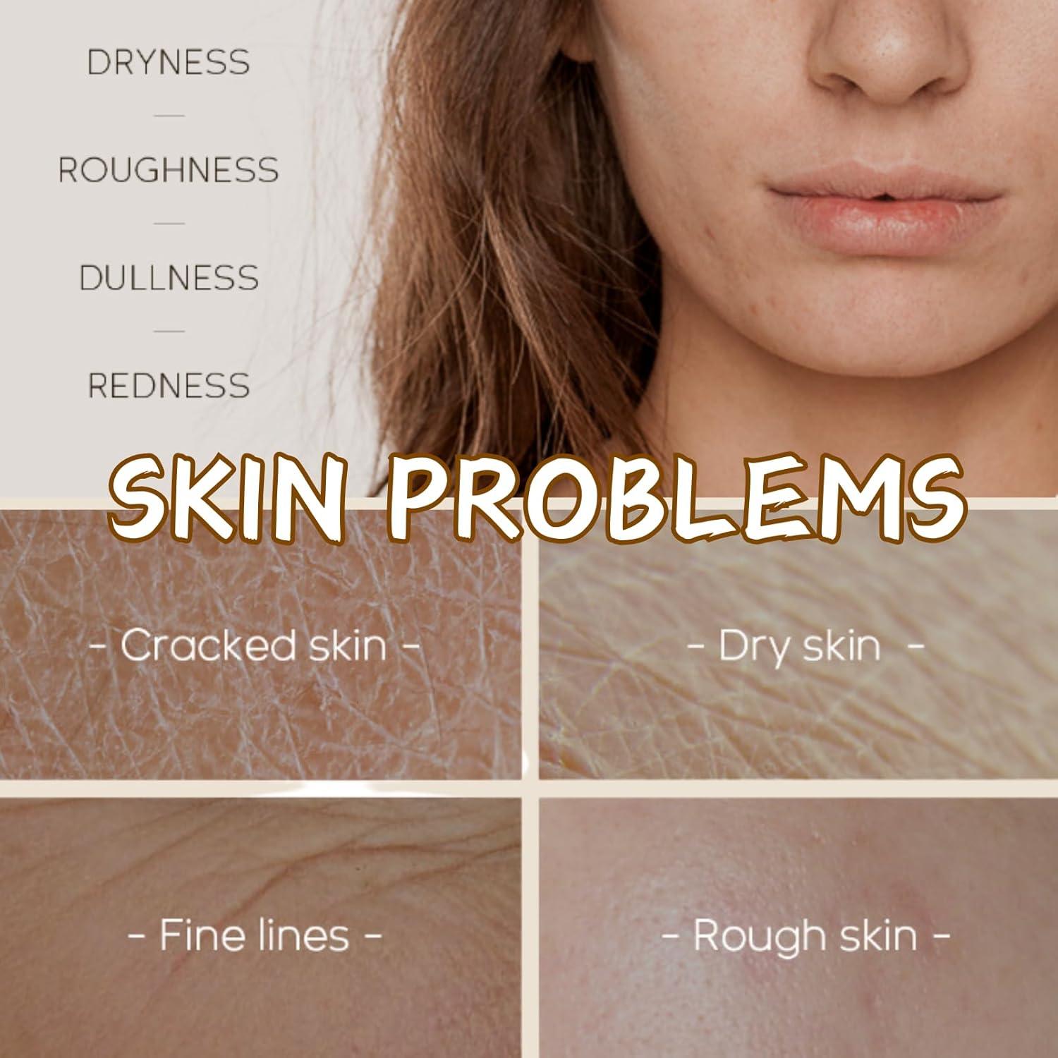 Kit de Cuidado de Piel Coreano Evolvique 5PCS Hidratante