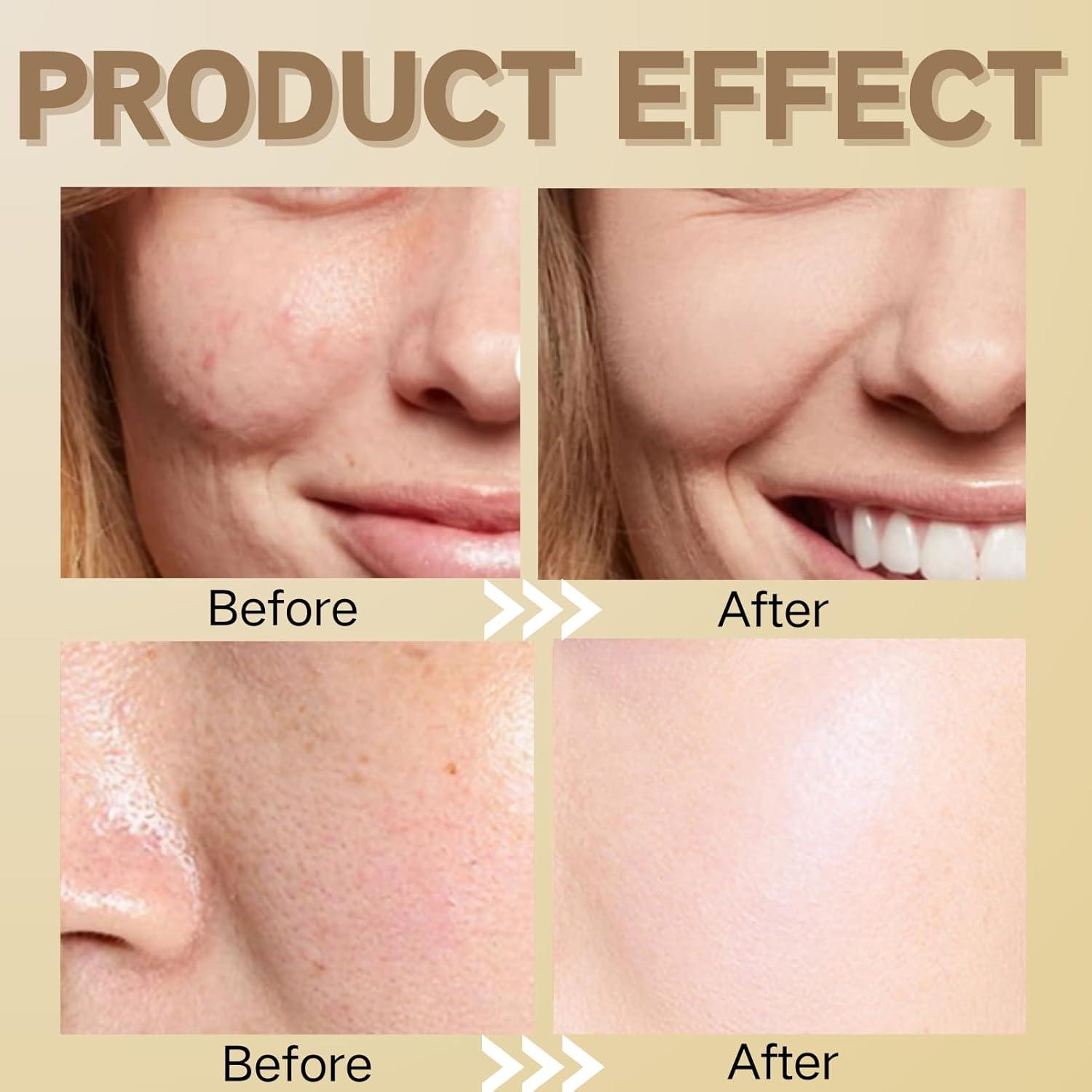 Kit de Cuidado de Piel Coreano Evolvique 5PCS Hidratante