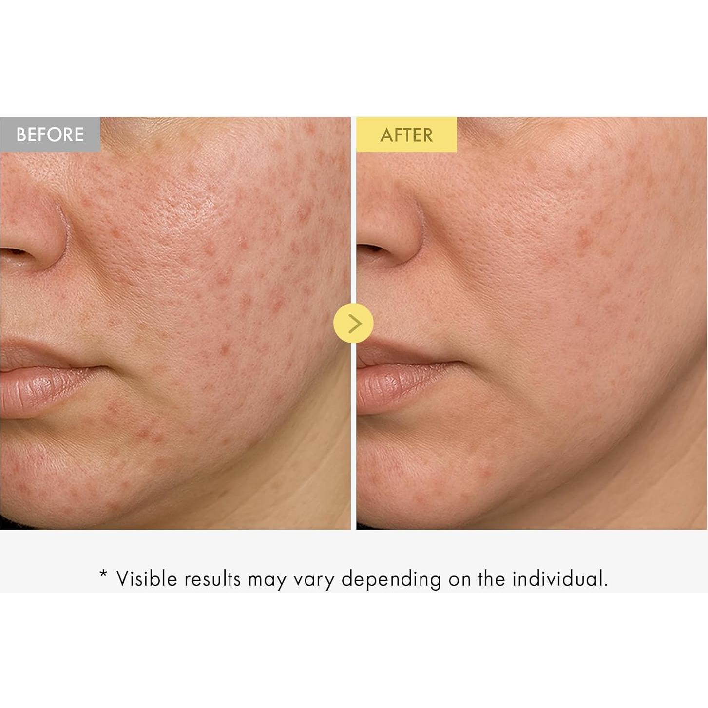 Suero Facial TOSOWOONG Honey Glow 65% 33ml - Hidratante y Brillante