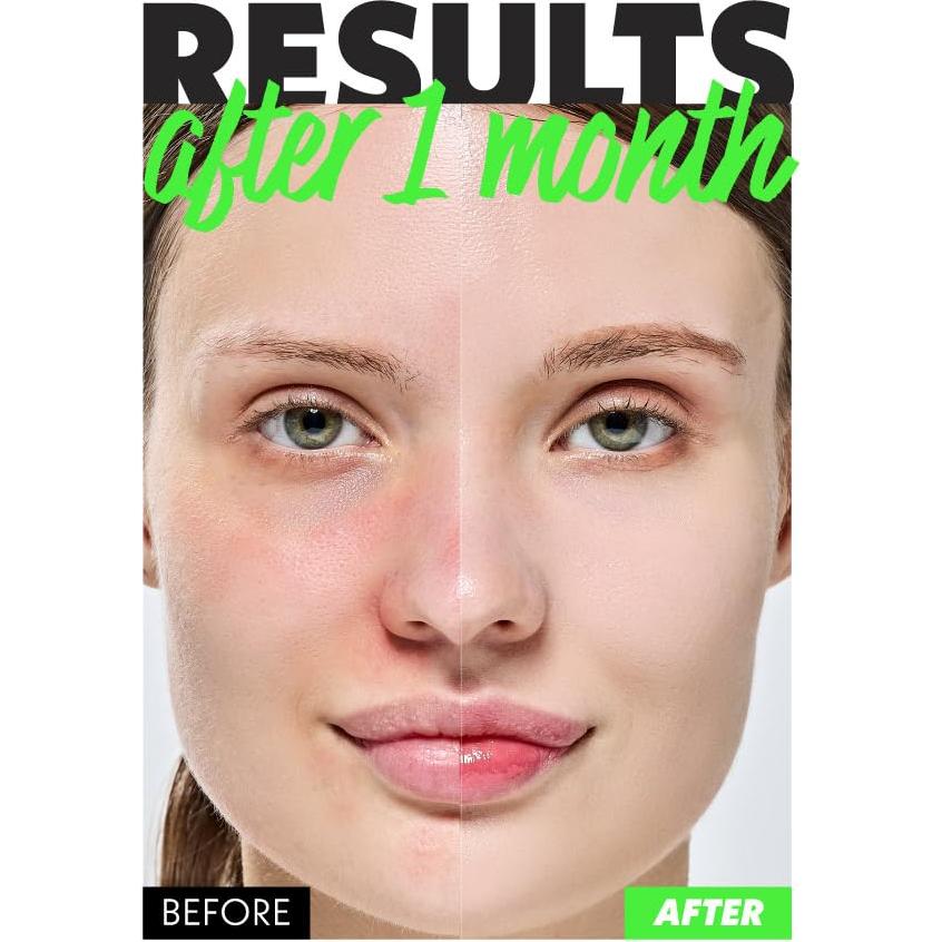 Suero Calmante NOSCA9 59.87 ml x 2 - Hidratante Piel Sensible