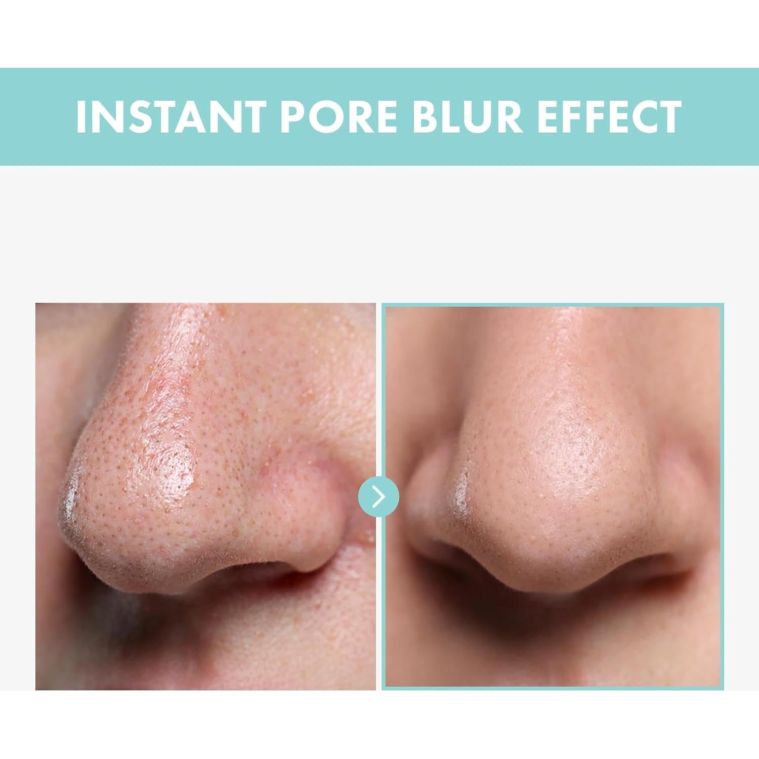 Suero Astringente de Poros TOSOWOONG 30ml - Niacinamida y Alantoína