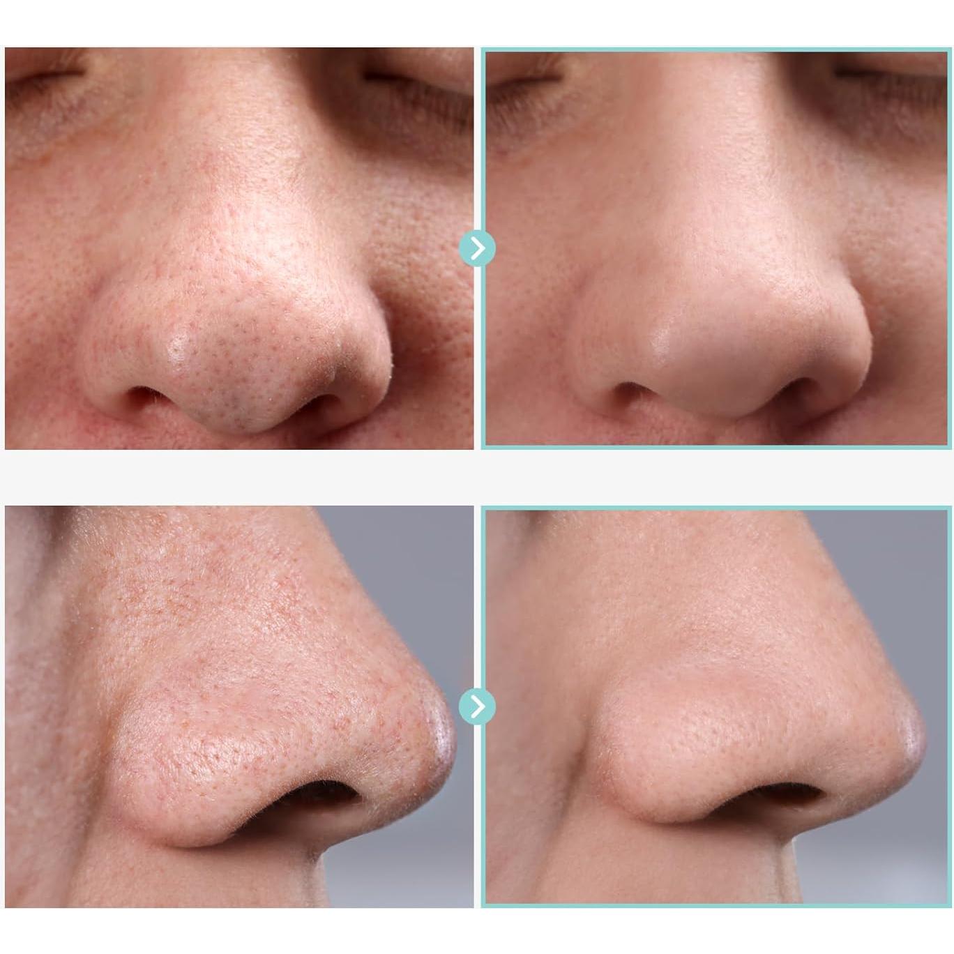 Suero Astringente de Poros TOSOWOONG 30ml - Niacinamida y Alantoína