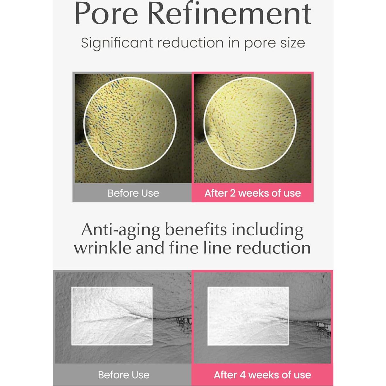 Suero de colágeno 4D Fusidyne 50ml - Hidratante Piel Radiante