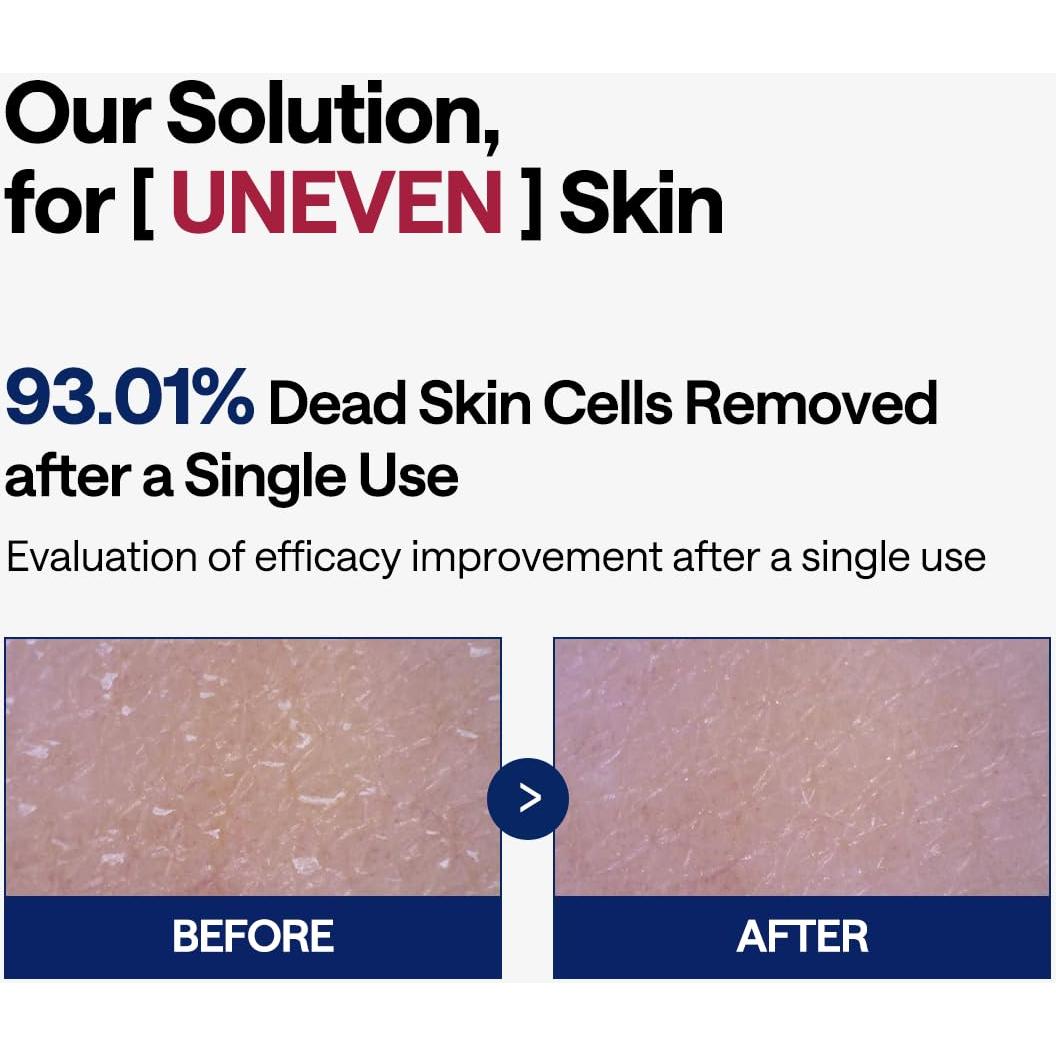 Almohadillas Exfoliantes Veganas MEDIHEAL 90 Unidades - Peeling Facial con LHA y Enzimas de Papaya