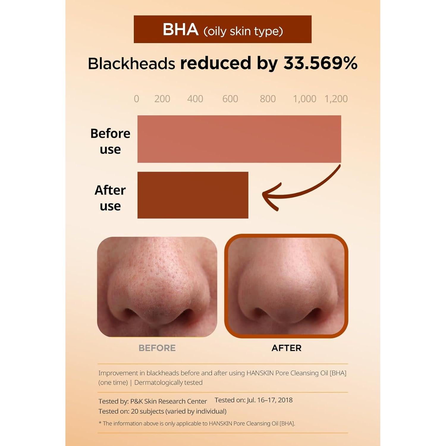 Hanskin Aceite Limpiador BHA 287 ml - Piel Mixta y Grasa