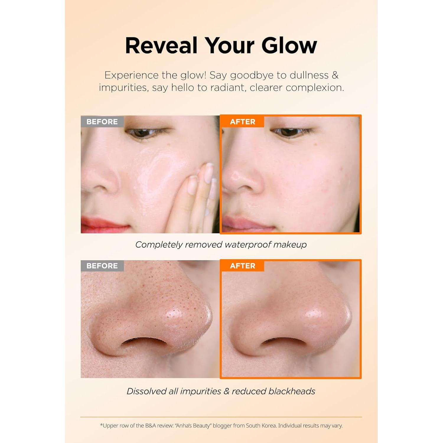 Bálsamo Limpiador de Poros Hanskin AHA 80g - Exfoliante Suave