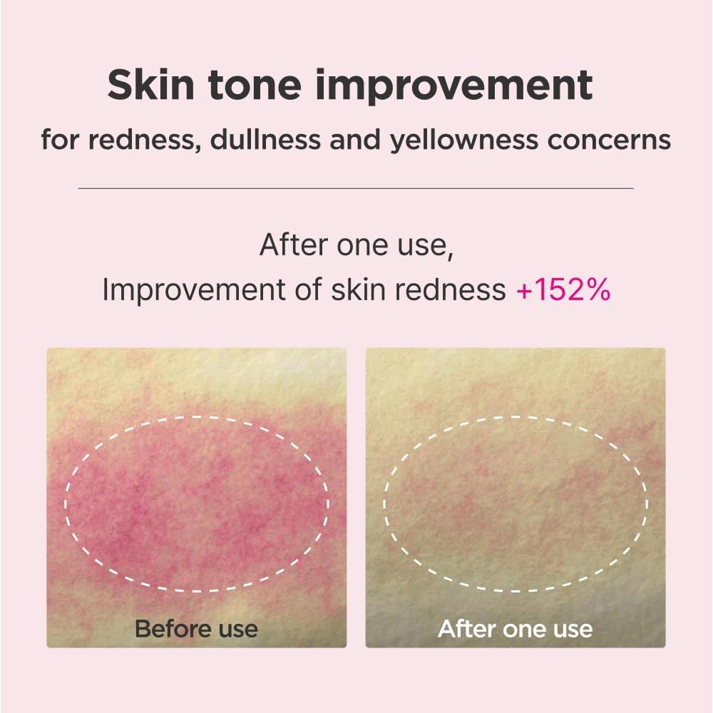 Kit de Cuidado de Piel ISOI 5 Pasos - Hidratación y Radiancia