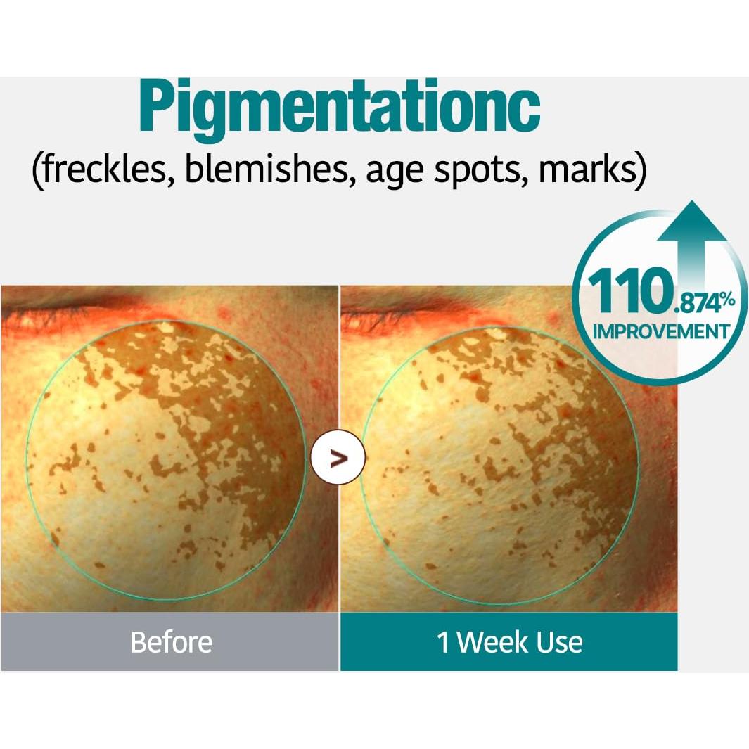 GOODAL Mascarilla de Gel Vita C y Colágeno 5 Piezas 340g