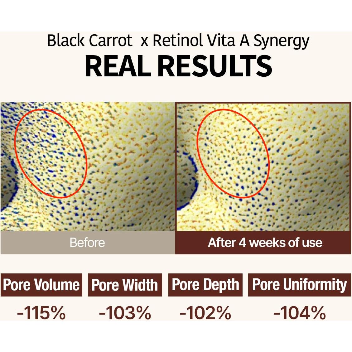 Ampoule Goodal Retinol VITA-A Zanahoria Negra 30ml Hidratante