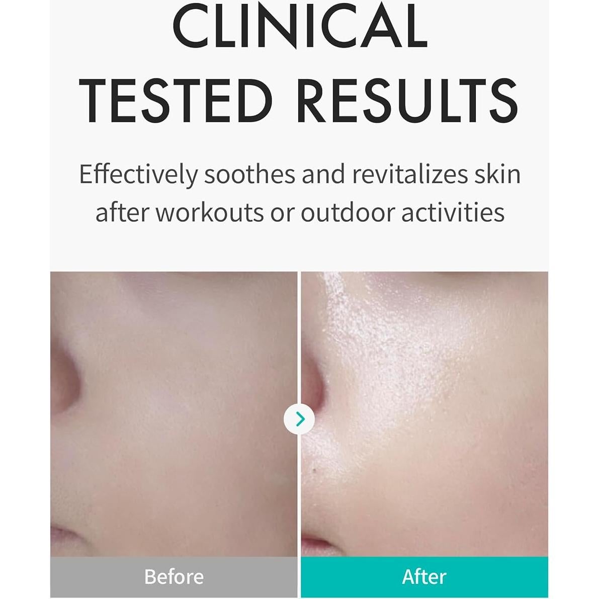 Mascarilla Facial Hidratante REJURAN c-PDRN 5 Unidades