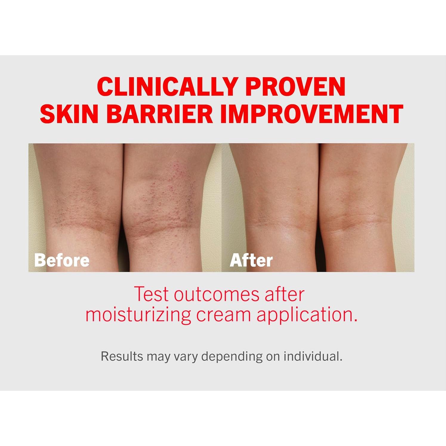 Crema Hidratante Intensiva ATOPALM 100ml Piel Seca y Sensible