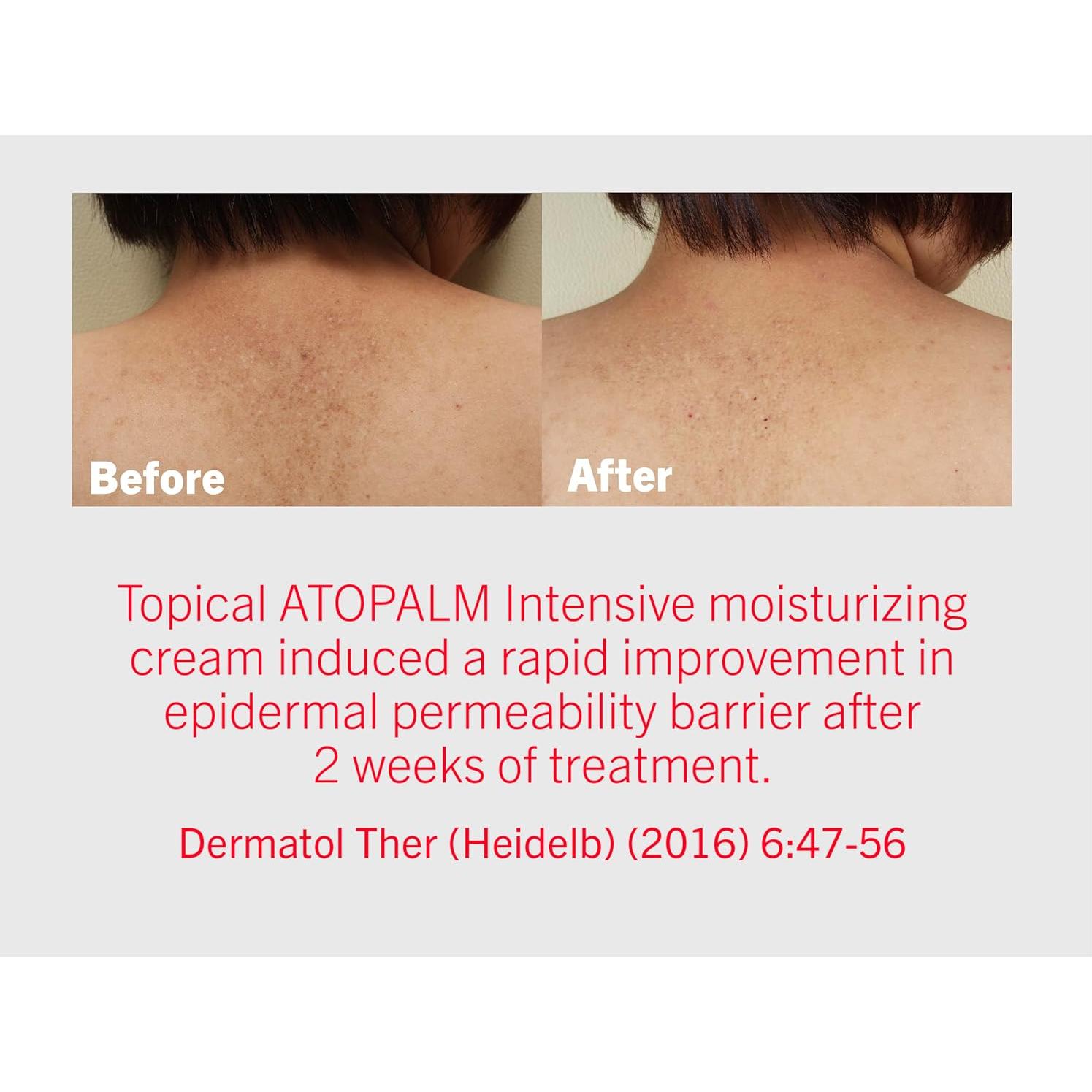 Crema Hidratante Intensiva ATOPALM 100ml Piel Seca y Sensible