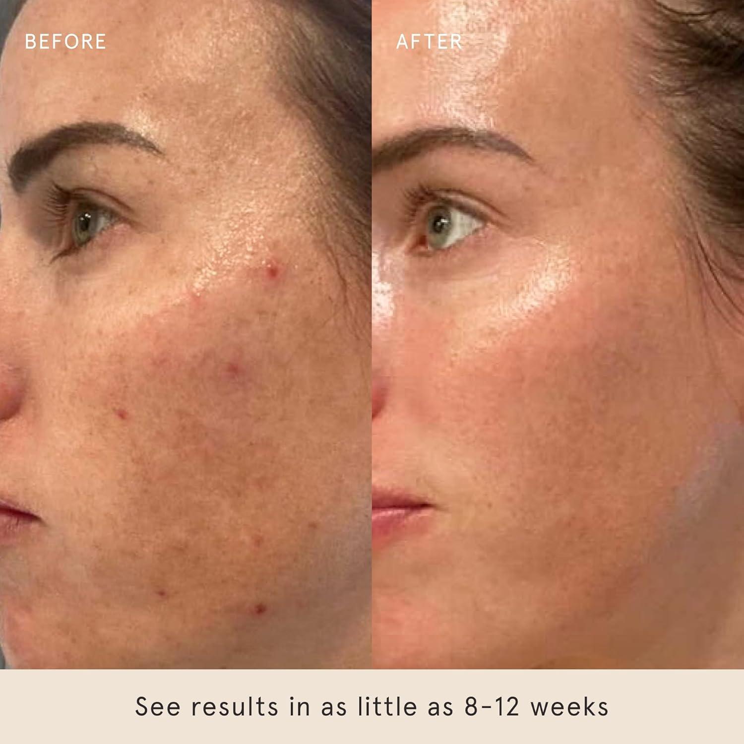 Suero Barefaced Retinal 30ml - Antiarrugas y Reafirmante