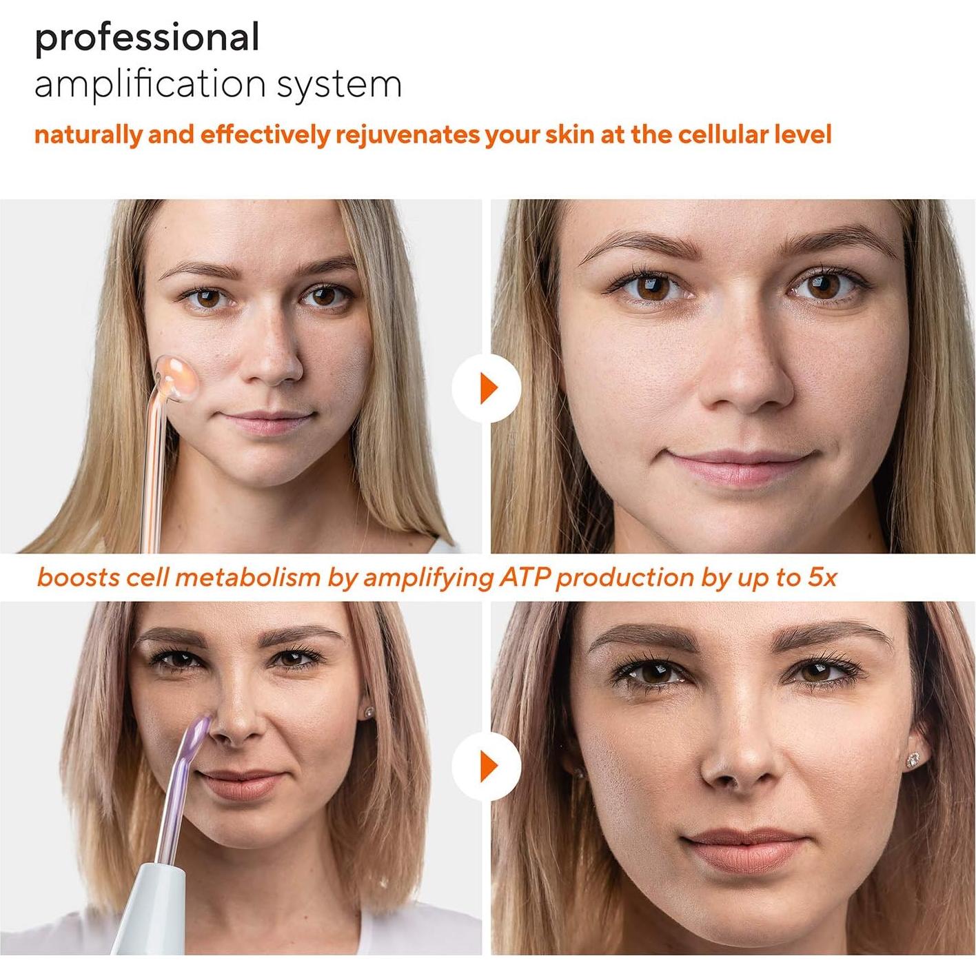 Máquina Terapia de Piel NuDerma Professional - 6 Varitas