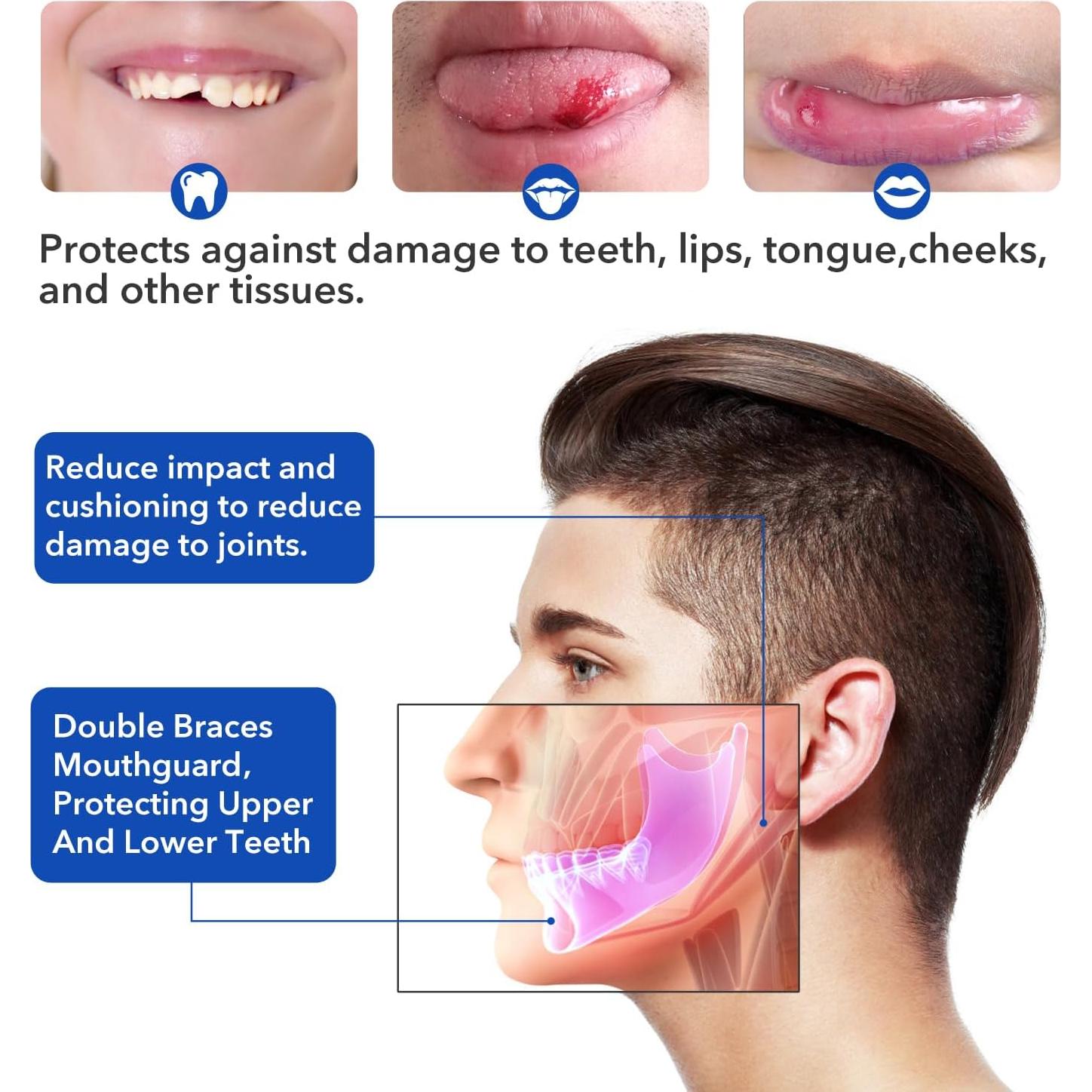 Protector Bucal Deportivo Doble Dick Being Azul Sin Hervir