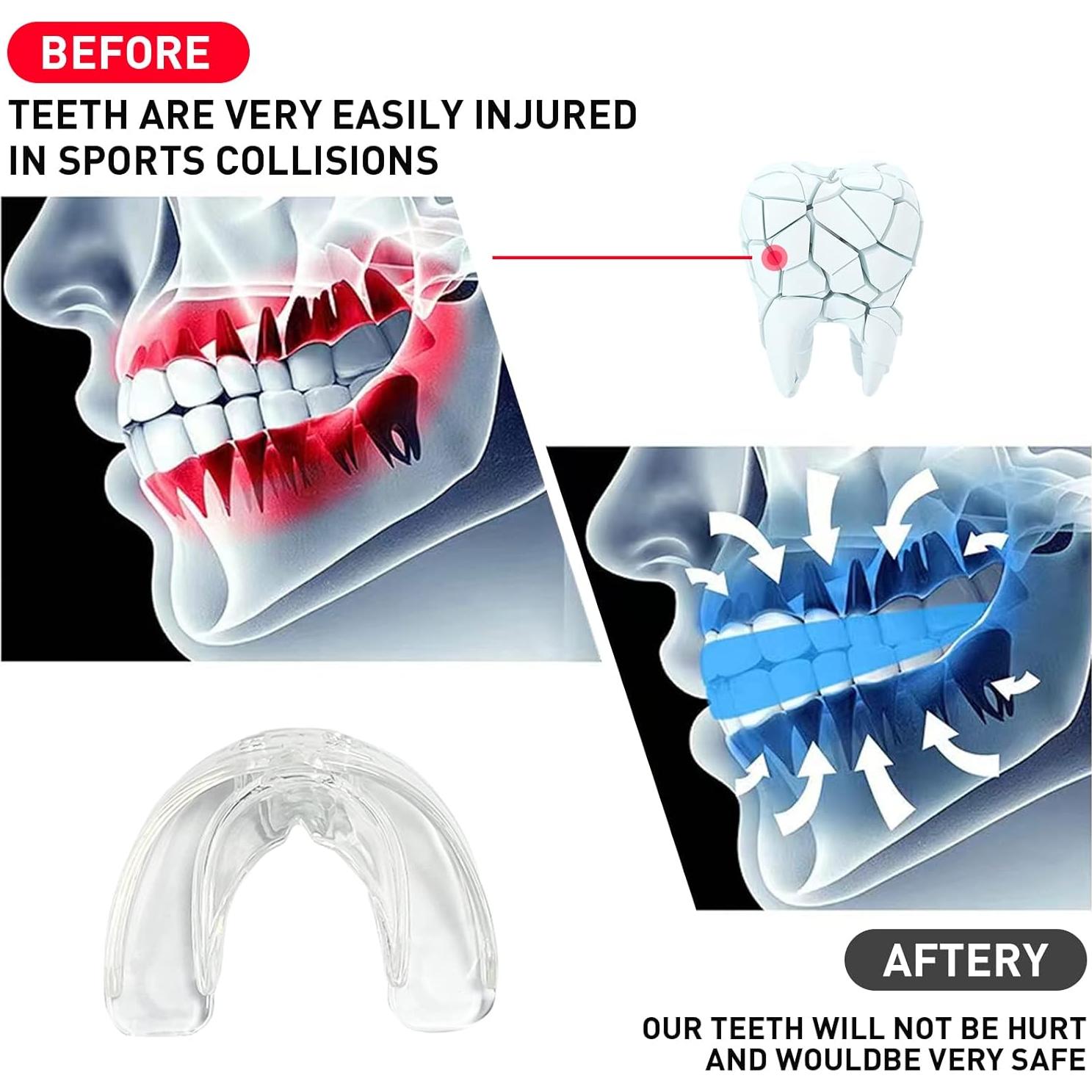Paquete de 3 Protectores Bucales YAFIYGI para Niños 10-16 Años