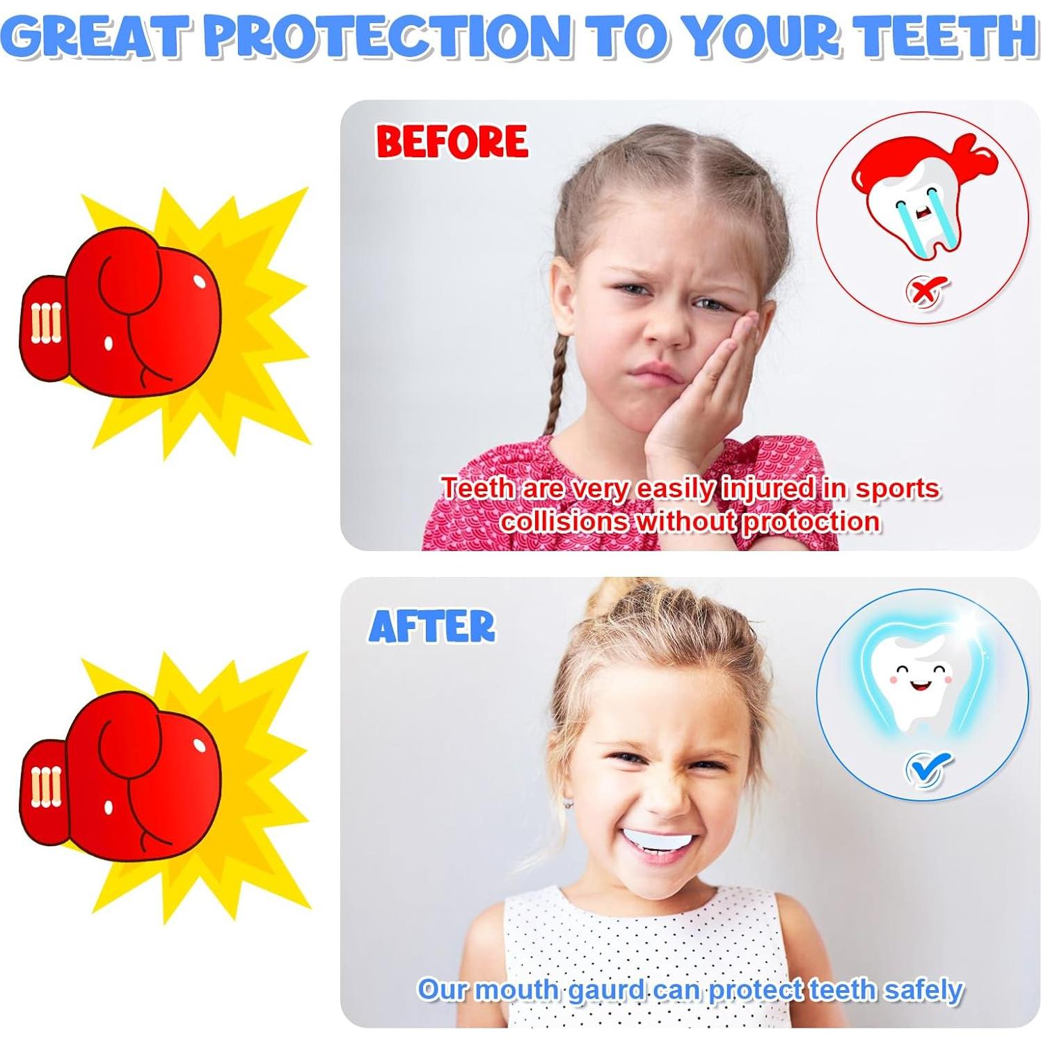 Protector Bucal Juvenil MENOLY 6 Piezas para Deportes