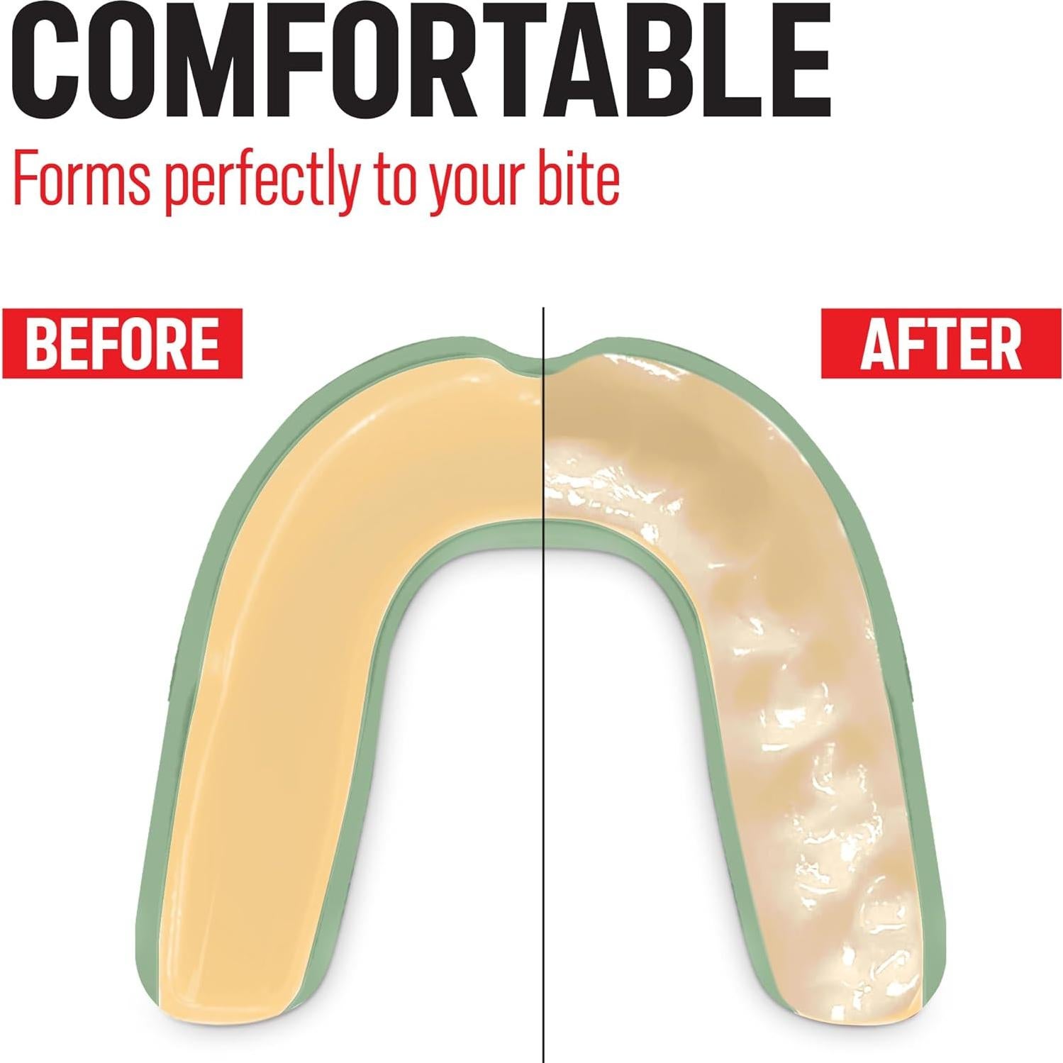 Protector Bucal NewHour para Boxeo y Deportes - Adultos y Niños