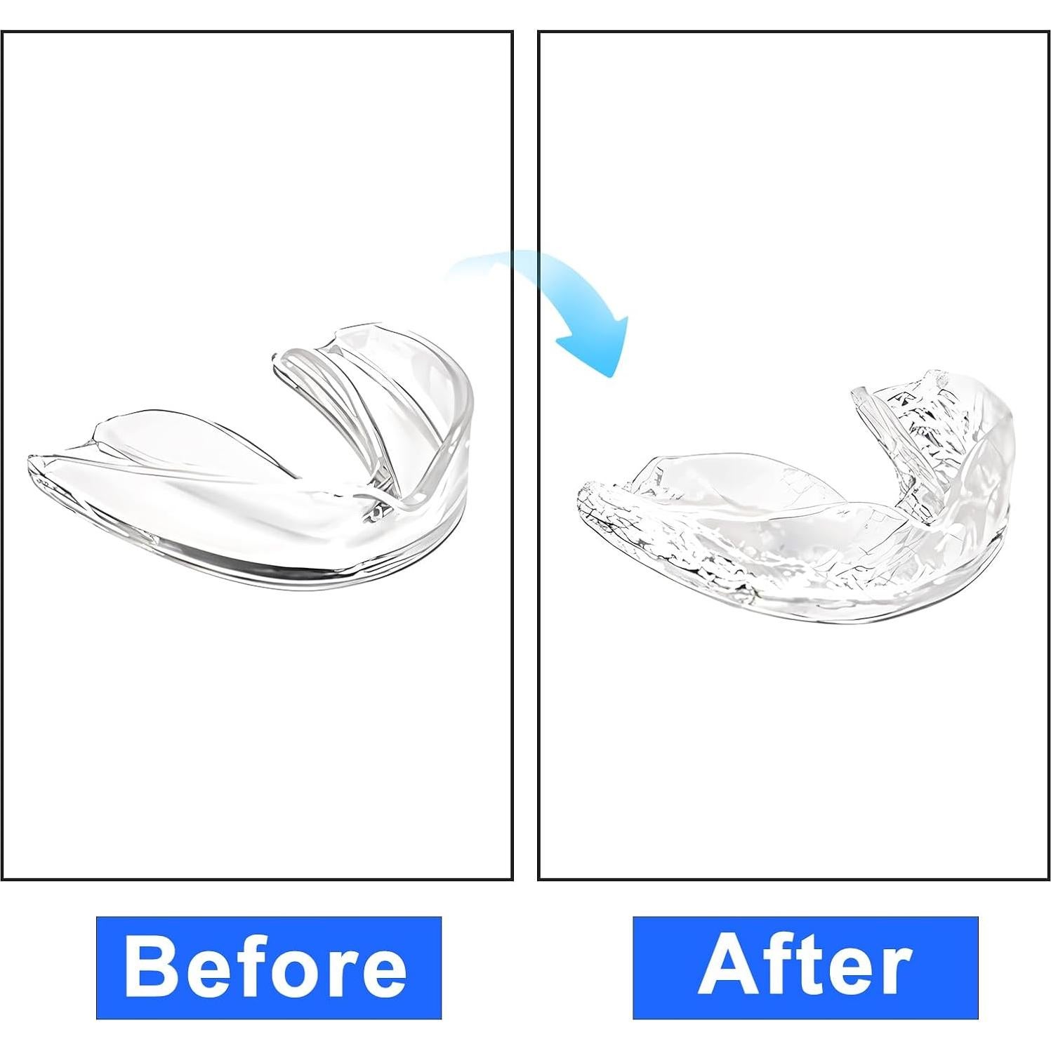 5 Protectores Bucales Deportivos Transparentes Ptwola 6.5x3.5cm