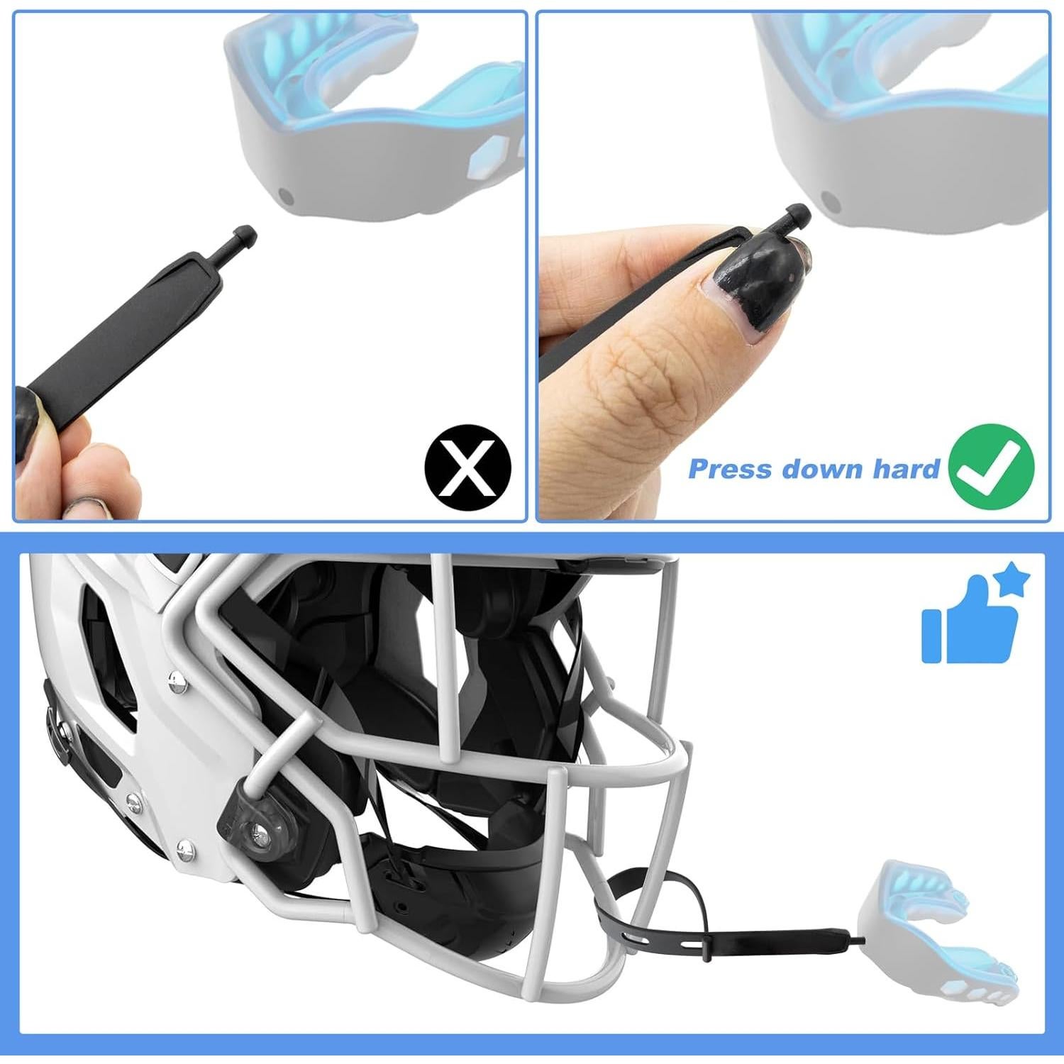 Paquete de 2 Sujetadores Universales para Protector Bucal Negro