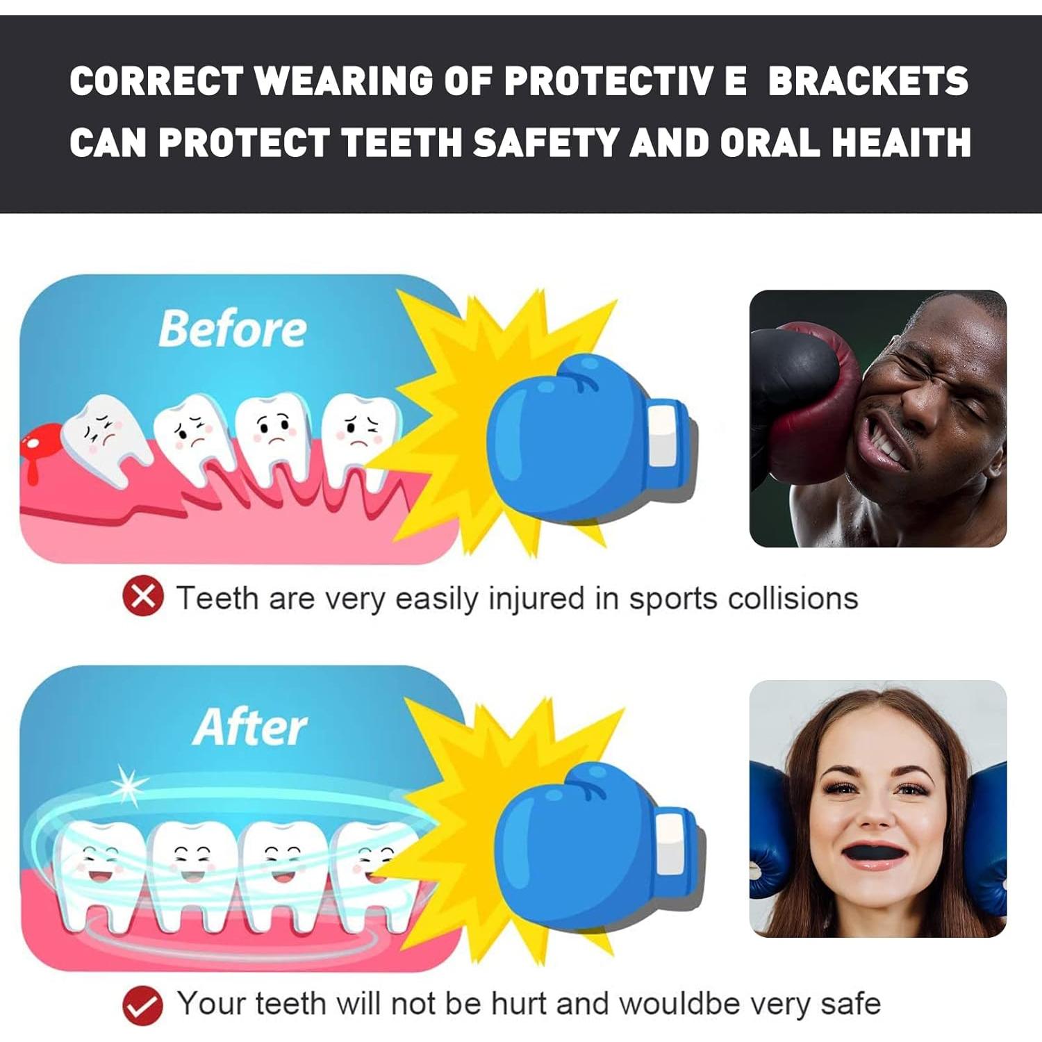 Paquete de 3 Protectores Bucales YAFIYGI para Niños 10-16 Años