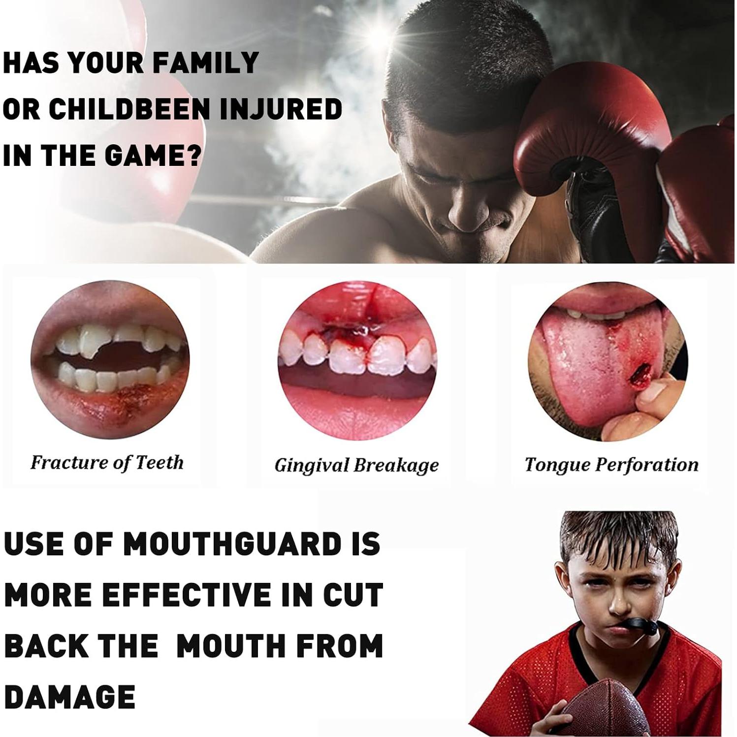 Paquete de 3 Protectores Bucales YAFIYGI para Niños 10-16 Años