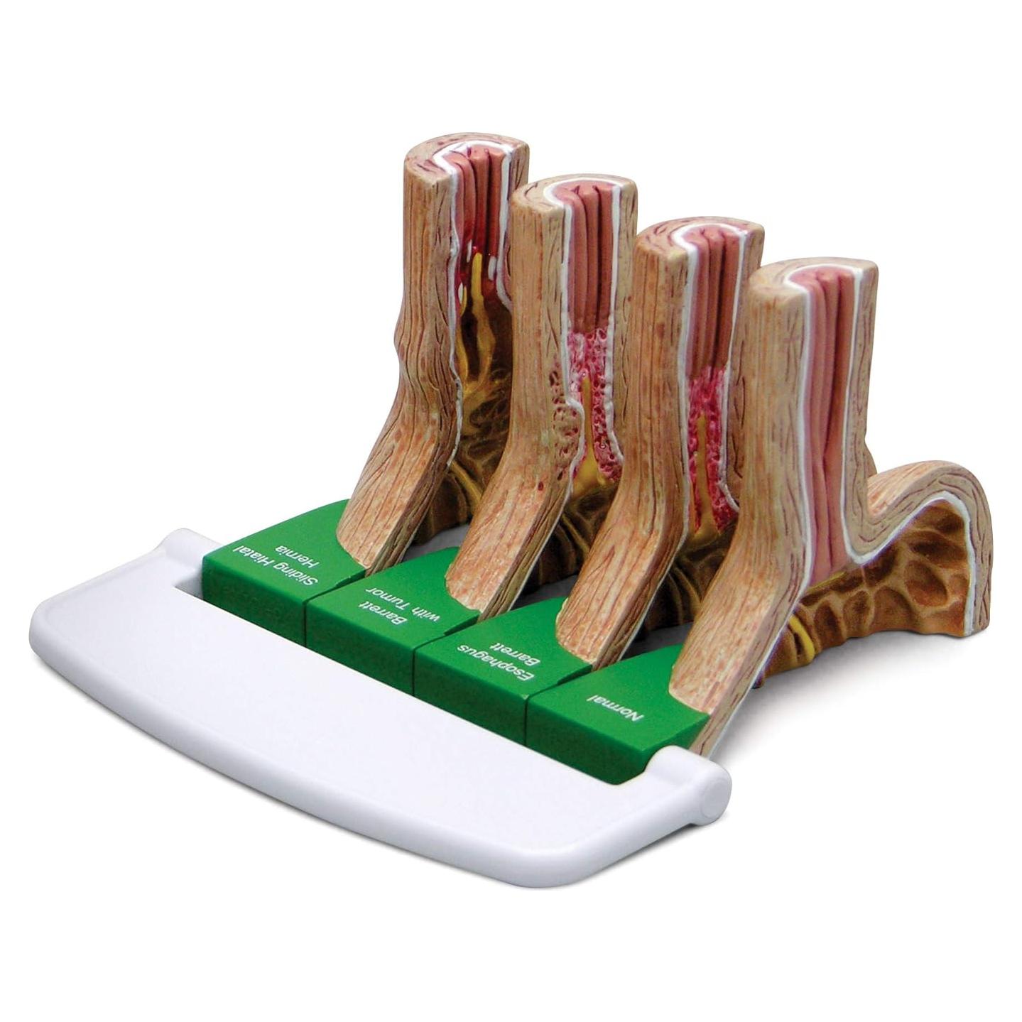 Modelo Estómago GERD GPI ANATOMICALS 10.16cm para Educación Médica