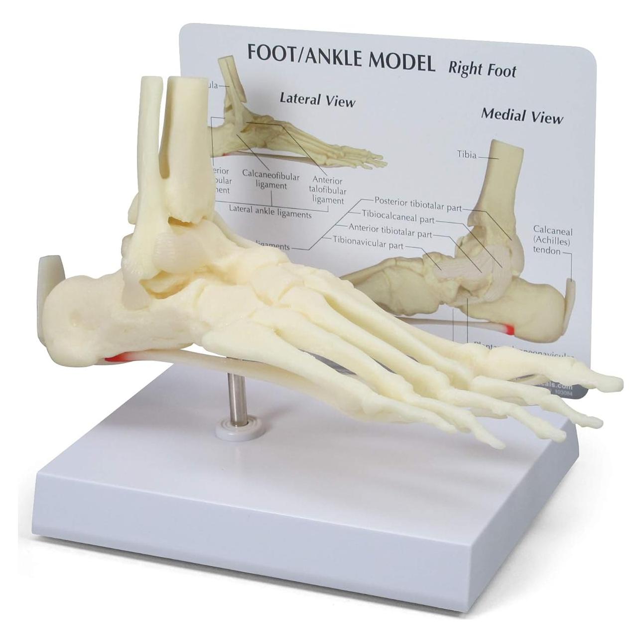 Modelo de Pie y Tobillo GPI Anatomicals con Fascitis Plantar