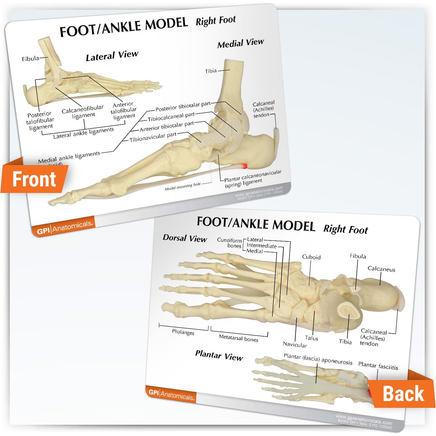 Modelo de Pie y Tobillo GPI Anatomicals con Fascitis Plantar