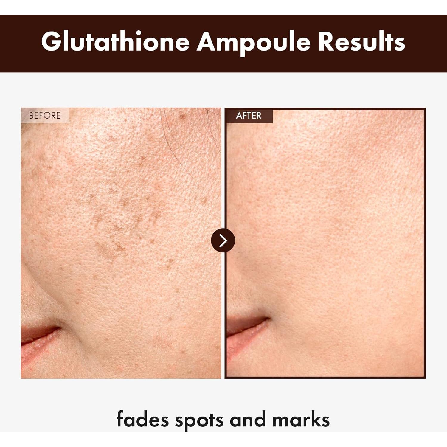 Suero Facial de Glutati&oacute;n TOSOWOONG 30ml - Antienvejecimiento